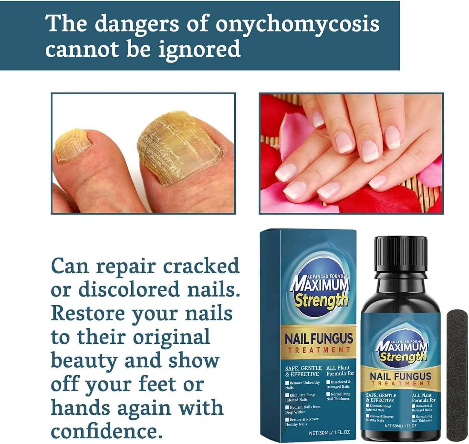 درمان قارچ ناخن LBOYLOVE®، درمان فوق العاده قوی قارچ ناخن برای ناخن پا و ناخن دست، ترمیم ضد قارچی ناخن برای ناخن های ضخیم، شکسته و تغییر رنگ داده، فرمول رشد سریع ناخن درمان قارچ ناخن LBOYLOVE®، درمان فوق العاده قوی قارچ ناخن برای ناخن پا و ناخن دست، ترمیم ضد قارچی ناخن برای ناخن های ضخیم، شکسته و تغییر رنگ داده، فرمول رشد سریع ناخن