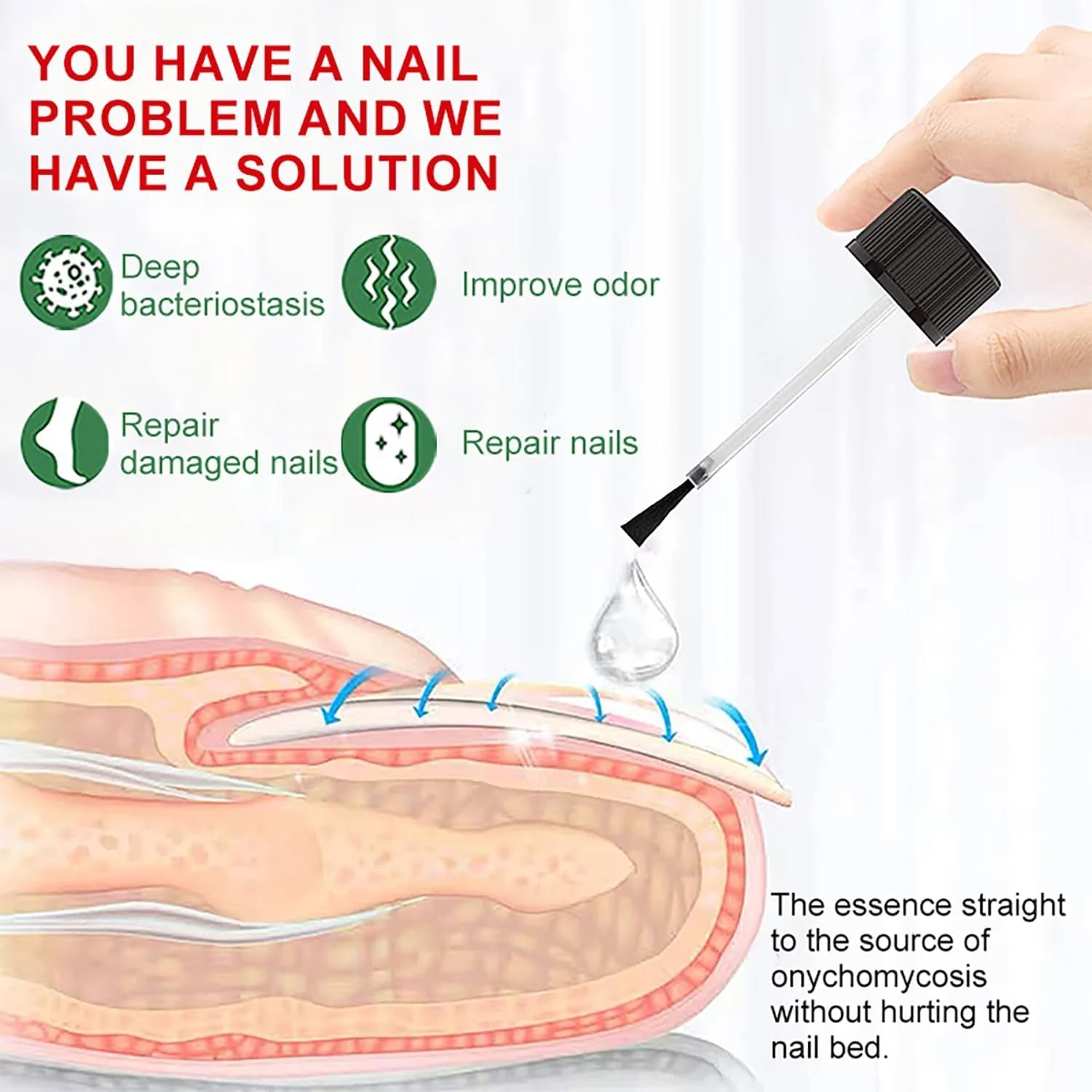 محلول درمان قارچ ناخن LBOYLOVE® با قدرت فوق العاده، درمان قارچ ناخن، درمان قارچ ناخن پا، درمان پای ورزشکاران، درمان قارچ ناخن پا برای ناخن های قارچی (30 میلی لیتر) محلول درمان قارچ ناخن LBOYLOVE® با قدرت فوق العاده، درمان قارچ ناخن، درمان قارچ ناخن پا، درمان پای ورزشکاران، درمان قارچ ناخن پا برای ناخن های قارچی (30 میلی لیتر)