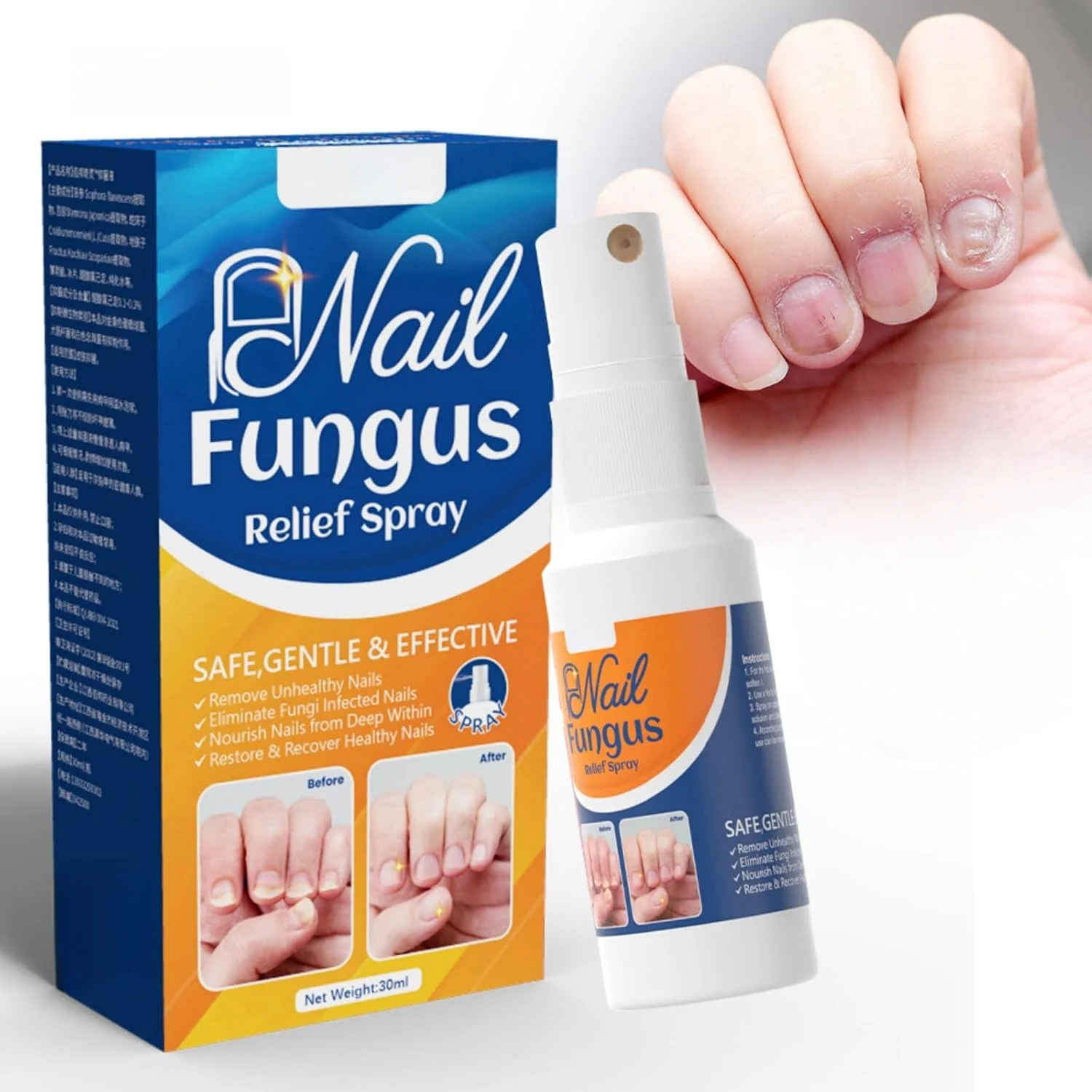 اسپری ضد قارچ ناخن JDLYEVER، 30 میلی لیتر - درمان موثر قارچ ناخن پا و ناخن دست - تسکین دهنده پای ورزشکاران، خوشبو کننده و از بین برنده بو - احیا کننده سلامت ناخن - جلوگیری از بازگشت قارچ