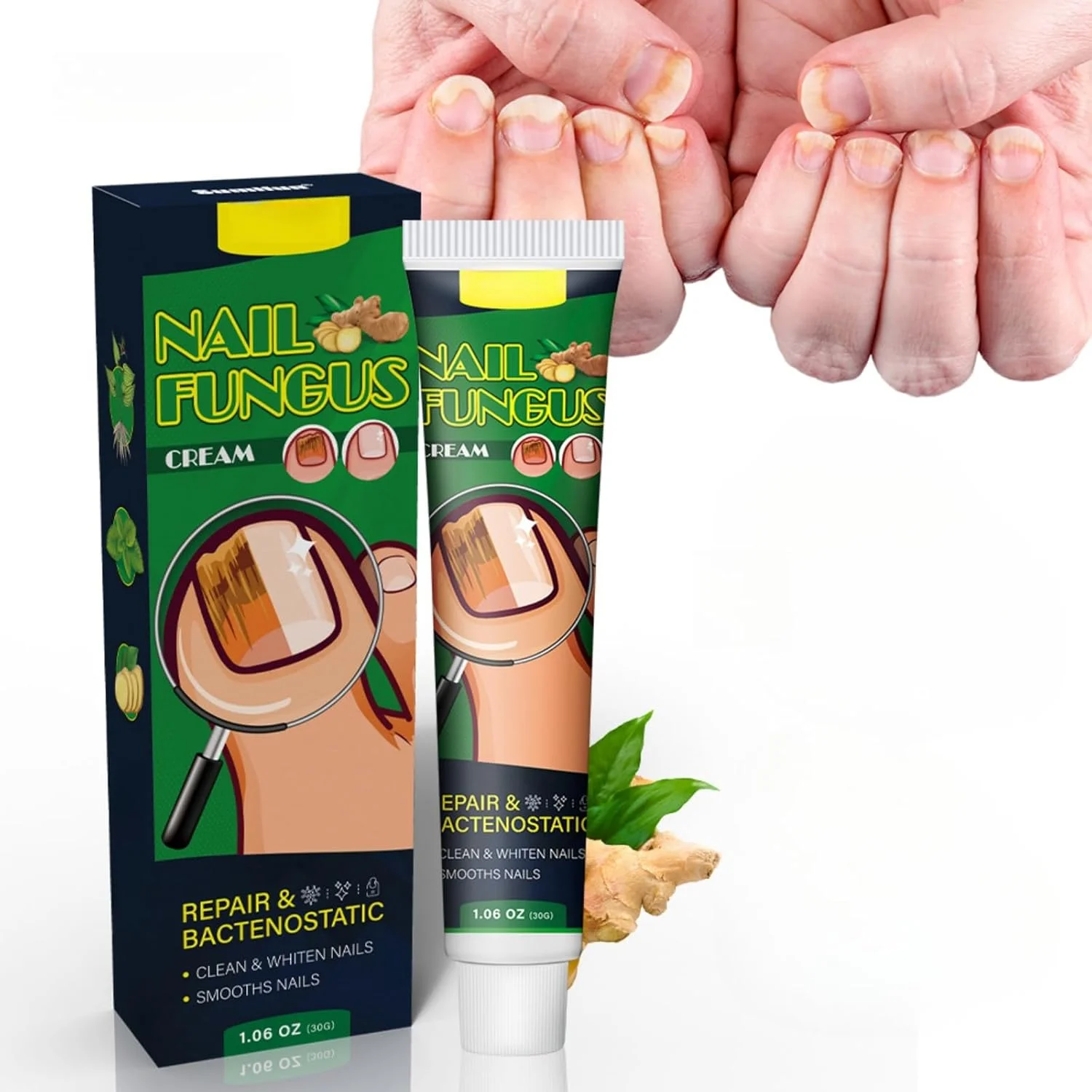 کرم ضد قارچ ناخن JDLYEVER، 30 گرم - درمان پیشرفته برای ناخن های ضخیم و تغییر رنگ داده - سلامت و ظاهر ناخن را بازیابی می کند - تسکین عفونت قارچی - مناسب برای ناخن های فرورفته در گوشت و ترک خورده کرم ضد قارچ ناخن JDLYEVER، 30 گرم - درمان پیشرفته برای ناخن های ضخیم و تغییر رنگ داده - سلامت و ظاهر ناخن را بازیابی می کند - تسکین عفونت قارچی - مناسب برای ناخن های فرورفته در گوشت و ترک خورده