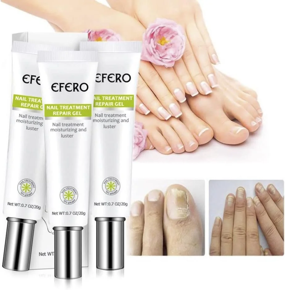 کانزا - ژل ترمیم کننده ناخن 3 عددی (20 گرم * 3) | ژل ترمیم ناخن قارچی، کرم ترمیم ناخن برای عفونت های قارچی و باکتریایی در ناخن های دست و پا | ترمیم آسیب ناخن و برای ناخن های سالم | مناسب برای همه کانزا - ژل ترمیم کننده ناخن 3 عددی (20 گرم * 3) | ژل ترمیم ناخن قارچی، کرم ترمیم ناخن برای عفونت های قارچی و باکتریایی در ناخن های دست و پا | ترمیم آسیب ناخن و برای ناخن های سالم | مناسب برای همه