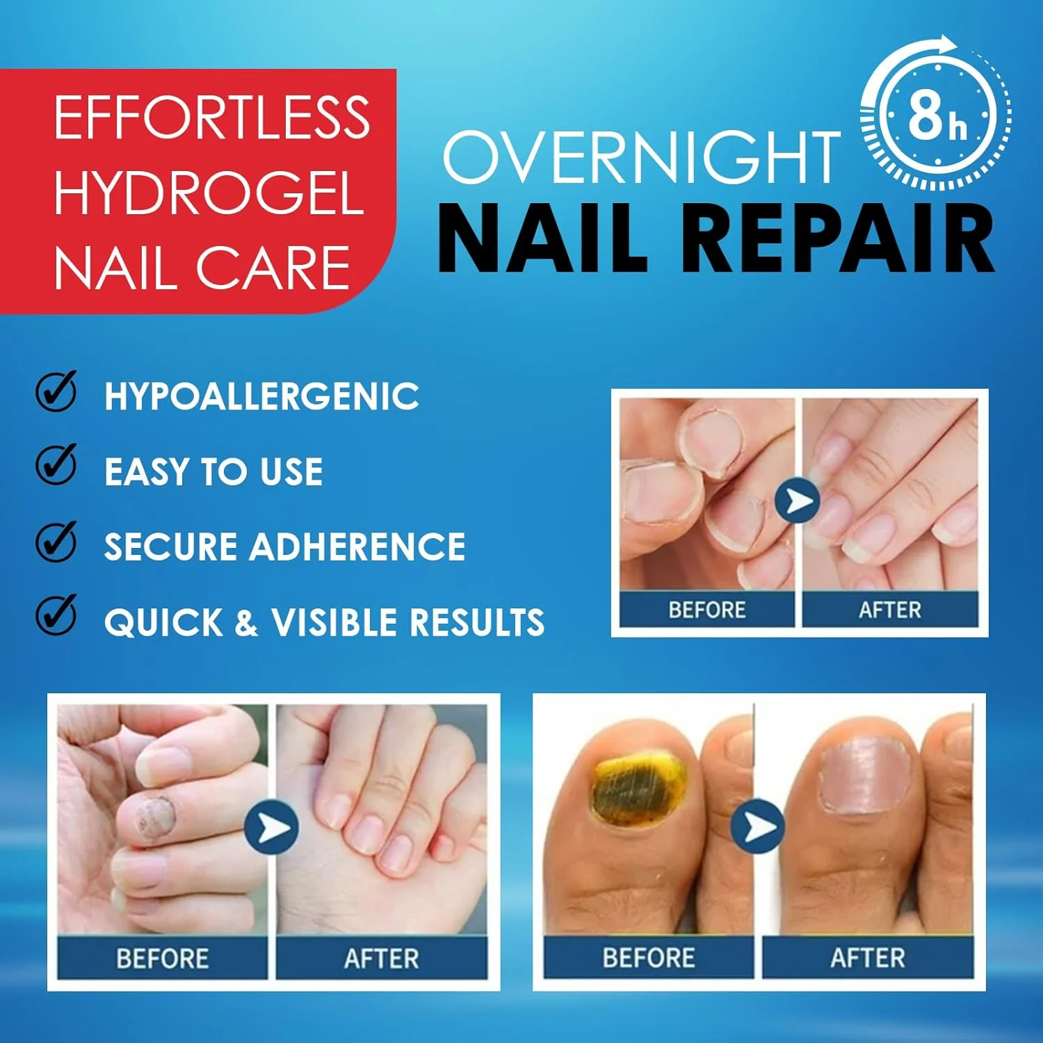 کانزا - 25 عدد پد ناخن قارچی | پد تجدید کننده ناخن قارچی 8 ساعته در طول شب | پد درمان پا | ترمیم قوی برای قارچ ناخن پا | پدهای درمان طبیعی برای ترمیم ناخن | استیکر ترمیم ناخن انگشت پا کانزا - 25 عدد پد ناخن قارچی | پد تجدید کننده ناخن قارچی 8 ساعته در طول شب | پد درمان پا | ترمیم قوی برای قارچ ناخن پا | پدهای درمان طبیعی برای ترمیم ناخن | استیکر ترمیم ناخن انگشت پا