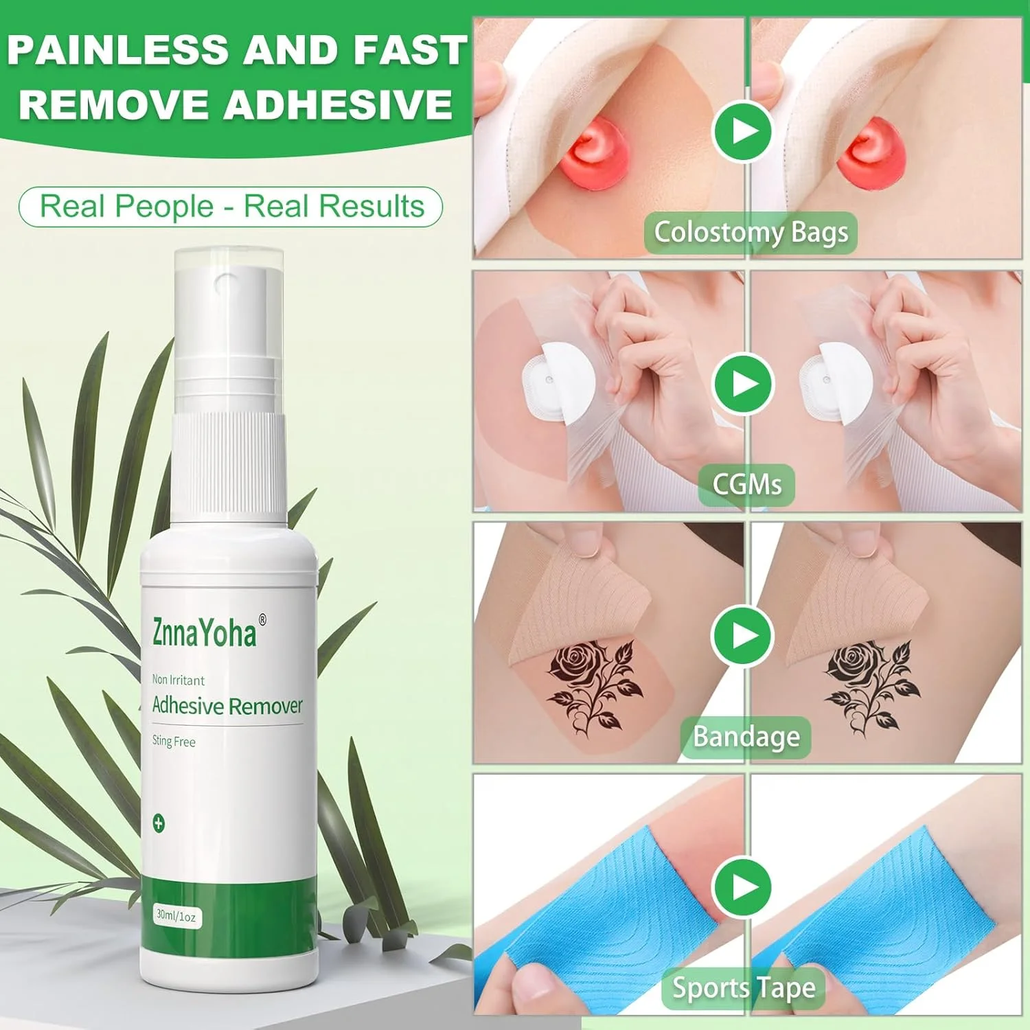 اسپری پاک کننده چسب ZnnaYoha، اسپری چسب پزشکی بدون سوزش، ایده آل برای بیماران استومی، پوست حساس و برداشتن بانداژ، کم باقیمانده، خشک شدن سریع، فرمول غیر چسبنده (4 عدد) اسپری پاک کننده چسب ZnnaYoha، اسپری چسب پزشکی بدون سوزش، ایده آل برای بیماران استومی، پوست حساس و برداشتن بانداژ، کم باقیمانده، خشک شدن سریع، فرمول غیر چسبنده (4 عدد)