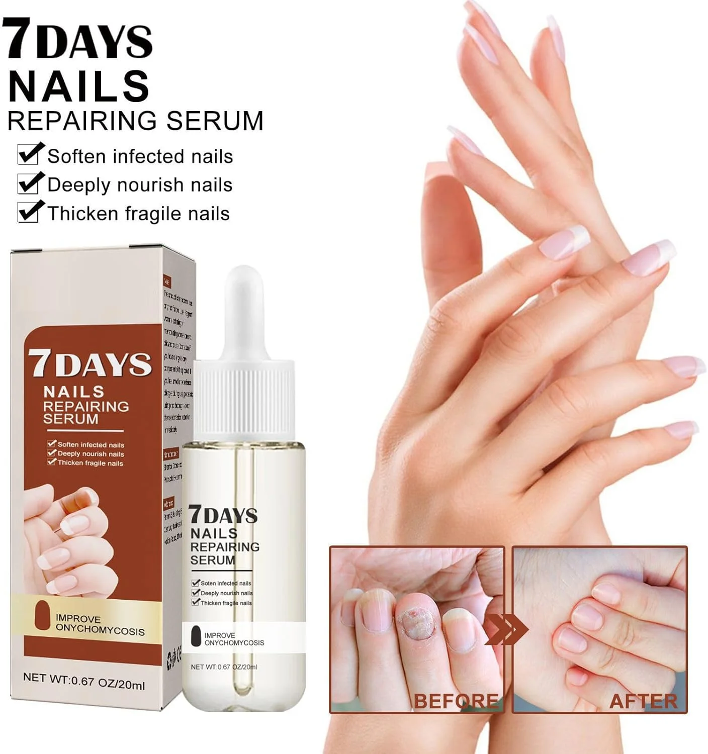 سرم ترمیم کننده ناخن 7 روزه (2 عدد) - فرمول مغذی و تقویت کننده برای رشد سریع، آبرسانی و بهبود سلامت ناخن، درمان اونیکومیکوزیس، جلوگیری از شکستگی و بهبود ظاهر