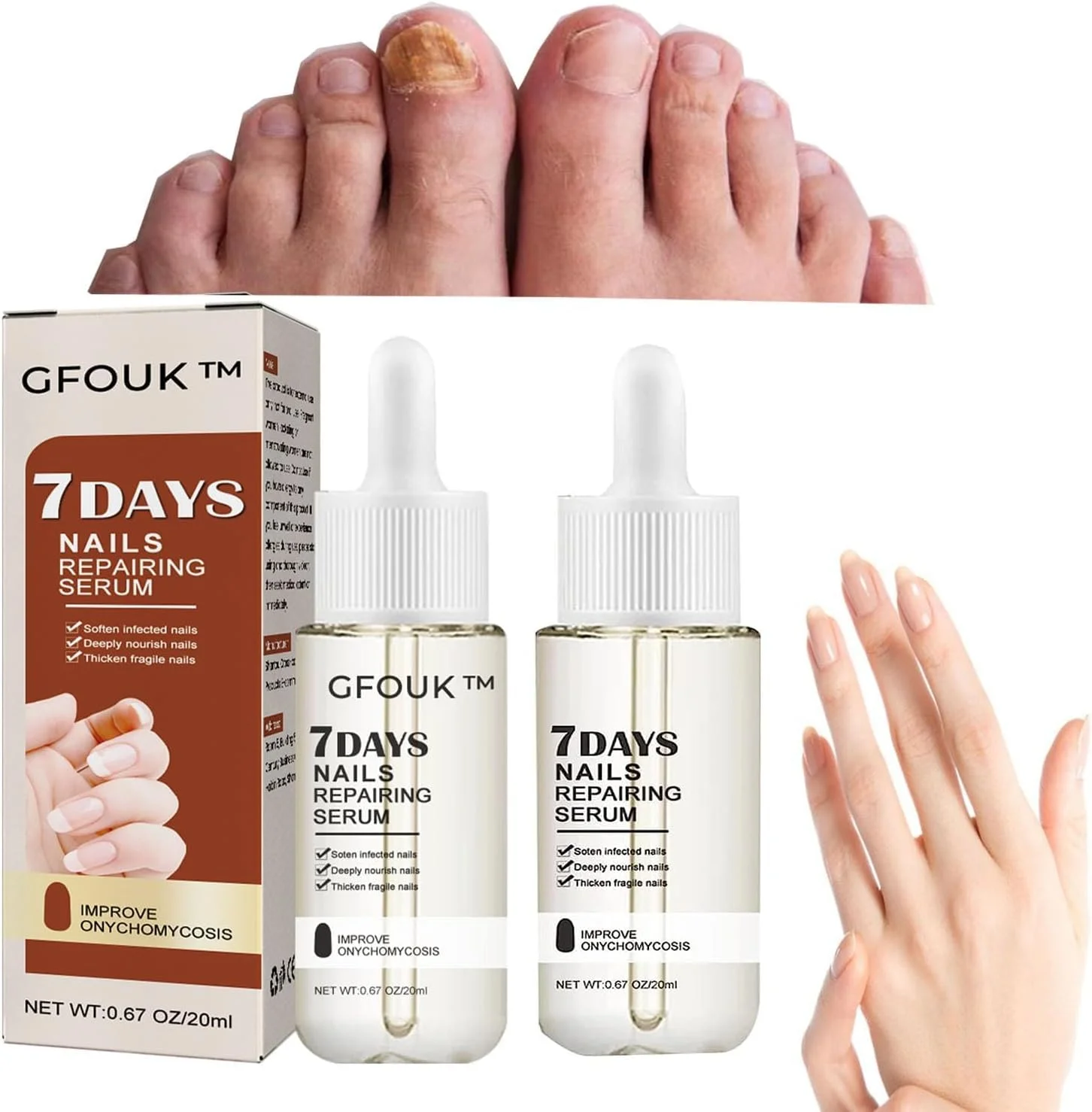 سرم ترمیم کننده ناخن 7 روزه، سرم ناخن برای رشد و ترمیم ناخن های آسیب دیده، محلول روغن ترمیم ناخن، درمان تقویت کننده ناخن برای ناخن های قوی تر در 1 هفته (2 عدد)