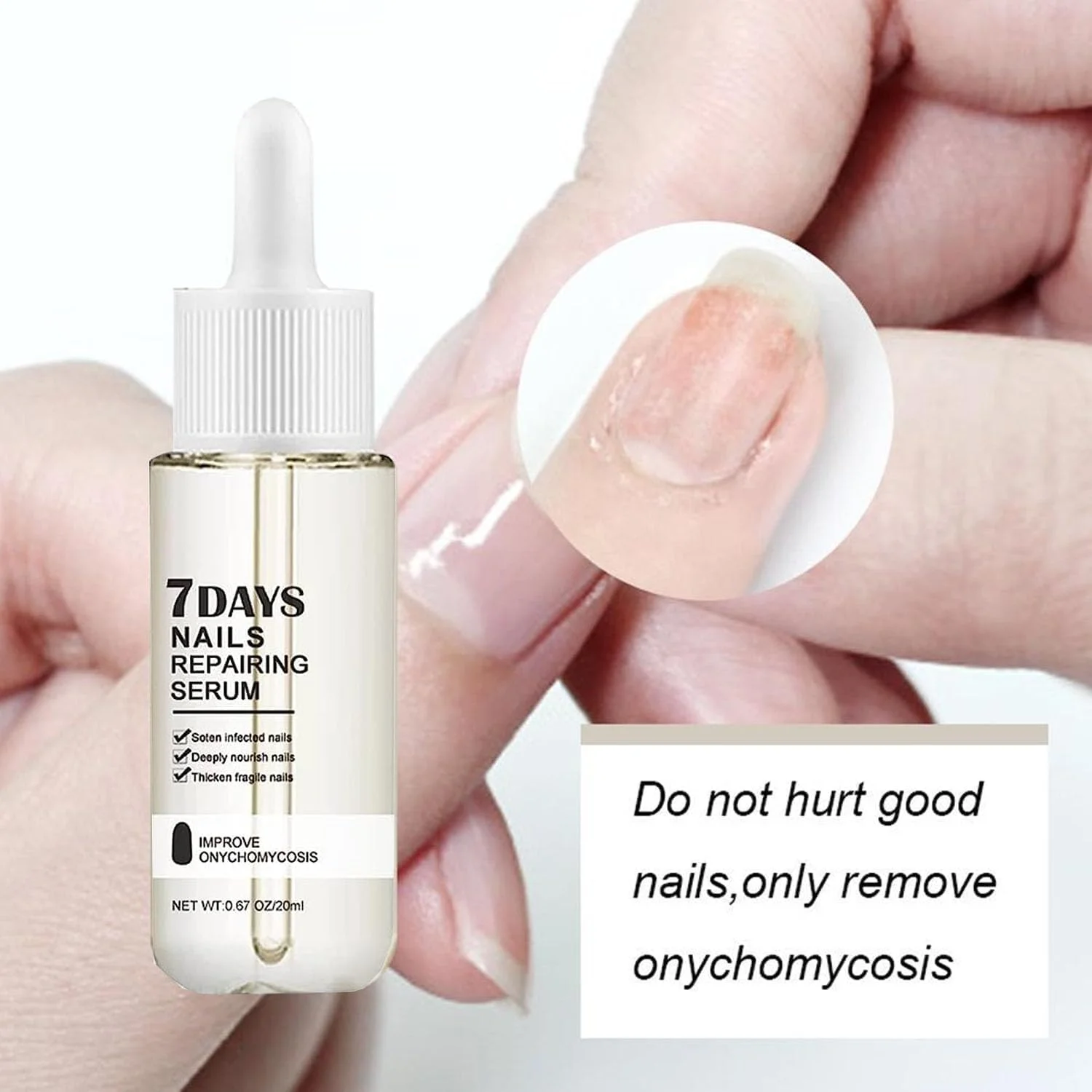 سرم ترمیم کننده ناخن 7 روزه، سرم ناخن برای رشد و ترمیم ناخن های آسیب دیده، محلول روغن ترمیم ناخن، درمان تقویت کننده ناخن برای ناخن های قوی تر در 1 هفته (2 عدد)