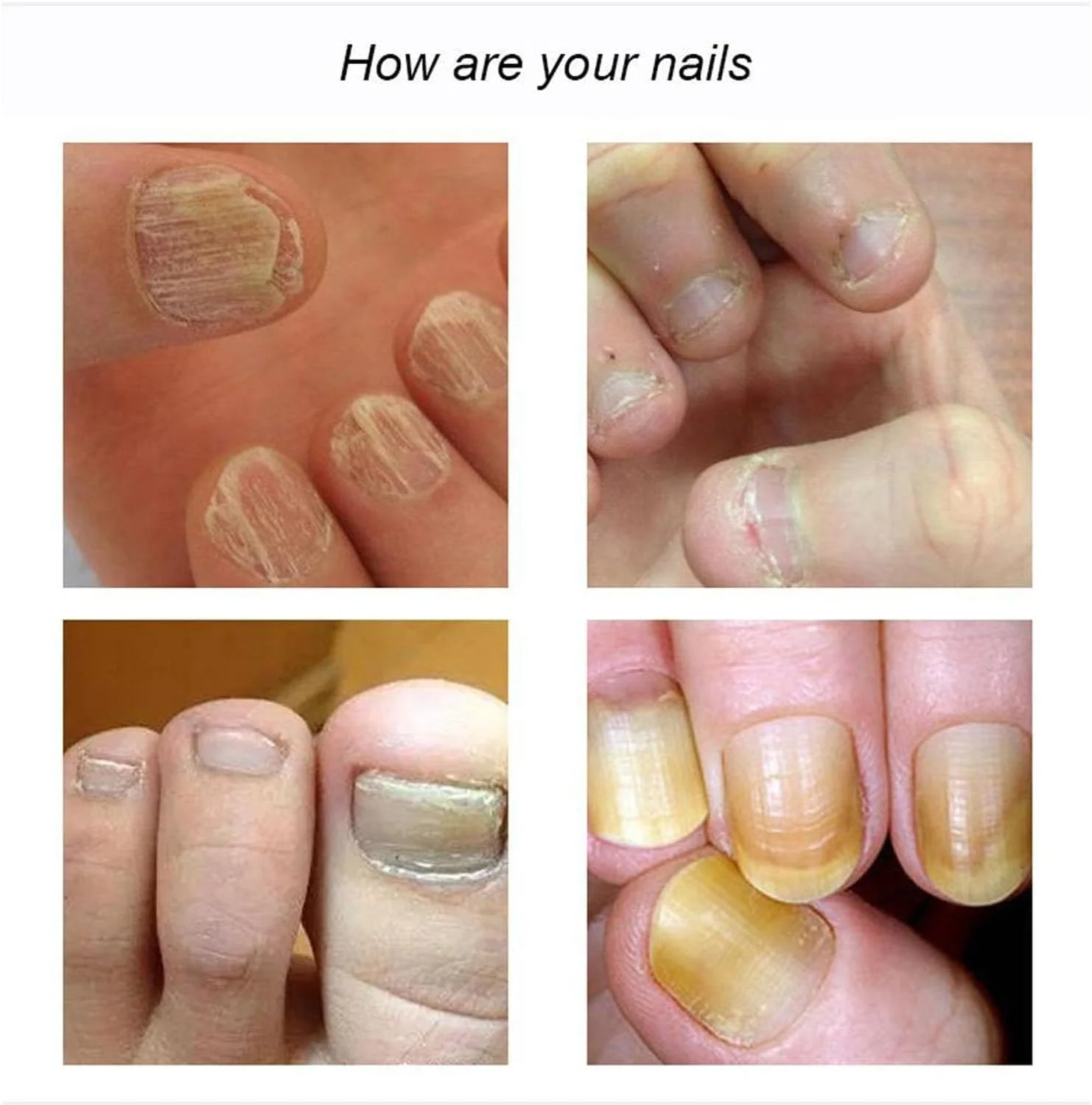 سرم ترمیم کننده ناخن 7 روزه، سرم ناخن برای رشد و ترمیم ناخن های آسیب دیده، محلول روغن ترمیم ناخن، درمان تقویت کننده ناخن برای ناخن های قوی تر در 1 هفته (2 عدد)