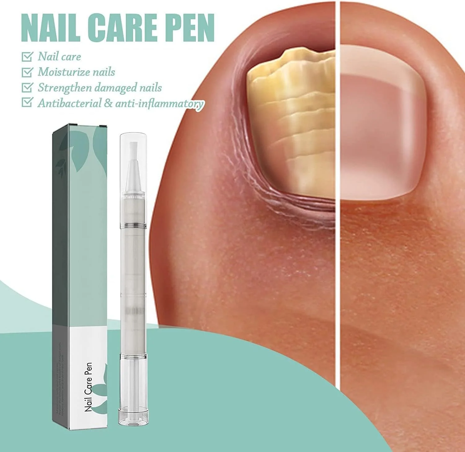 قلم مراقبت از ناخن گراگرا، محافظ ناخن و کوتیکول، 5 عدد قلم درمان قارچ ناخن پا، قلم تغذیه کننده مانیکور لبه انگشت، مراقبت از لبه پوست ناخن، قلم درمان رشد ناخن، قلم روغن ناخن