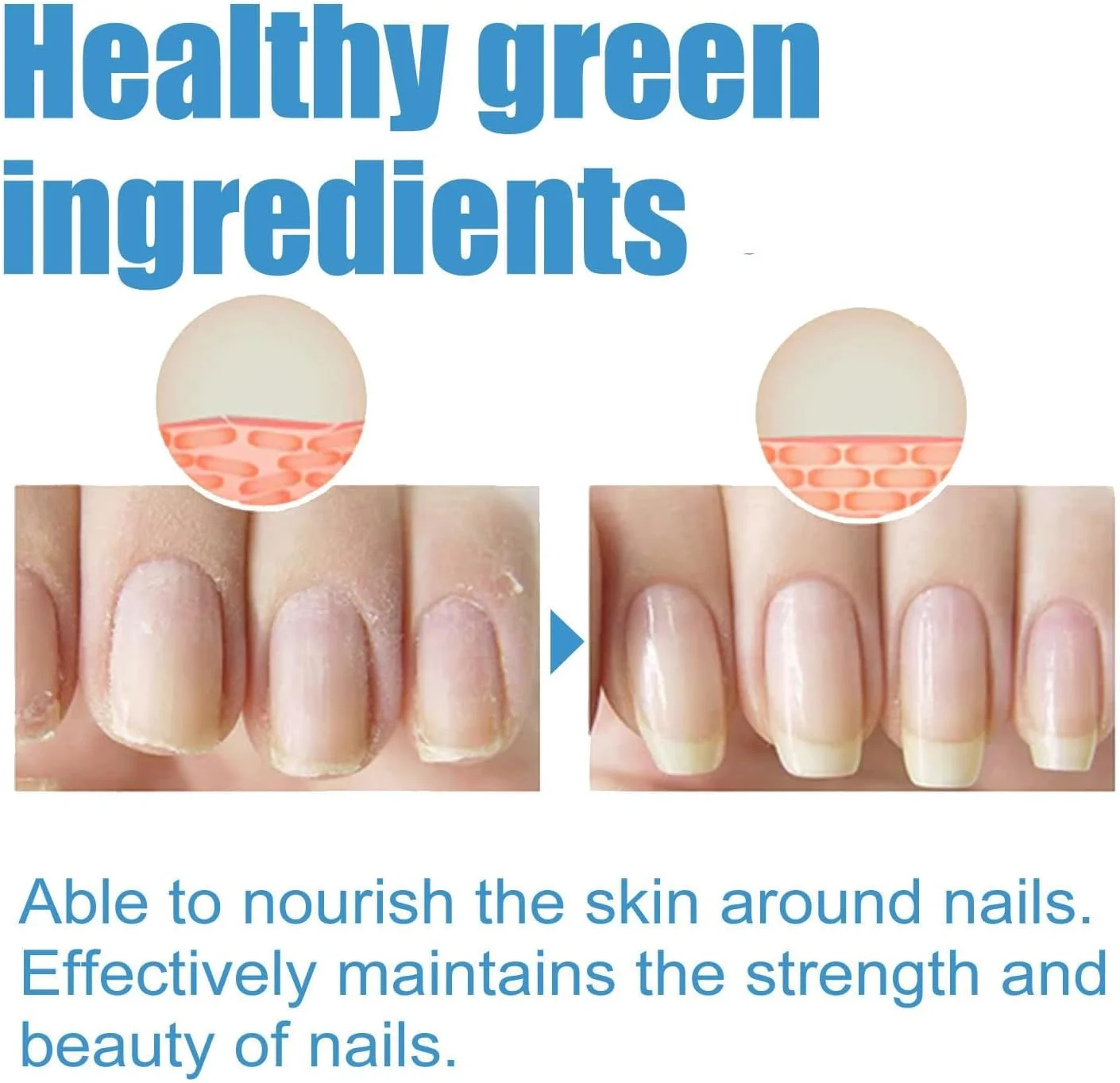 پچ های ترمیم ناخن Aputue، 32 عدد پچ درمان غیر قابل جابجایی ناخن، پچ های تجدید کننده شبانه برای ناخن های قارچی و شکننده پچ های ترمیم ناخن Aputue، 32 عدد پچ درمان غیر قابل جابجایی ناخن، پچ های تجدید کننده شبانه برای ناخن های قارچی و شکننده