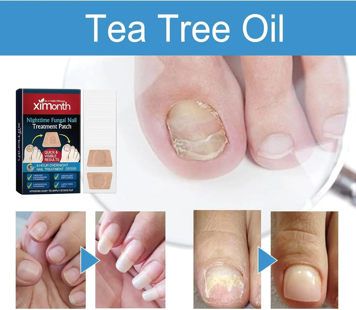 پچ های ترمیم ناخن Aputue، 32 عدد پچ درمان غیر قابل جابجایی ناخن، پچ های تجدید کننده شبانه برای ناخن های قارچی و شکننده پچ های ترمیم ناخن Aputue، 32 عدد پچ درمان غیر قابل جابجایی ناخن، پچ های تجدید کننده شبانه برای ناخن های قارچی و شکننده