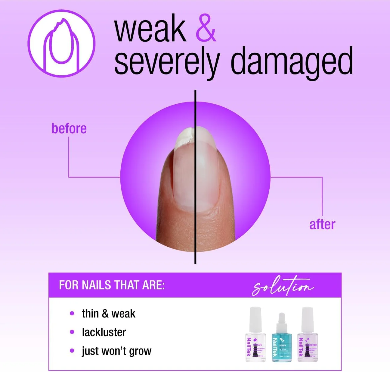 سیستم احیای ناخن نیل تک - ترمیم ناخن های آسیب دیده، آبرسانی، تجدید و تقویت کننده ناخن، ساخت آمریکا، 15 میلی لیتر