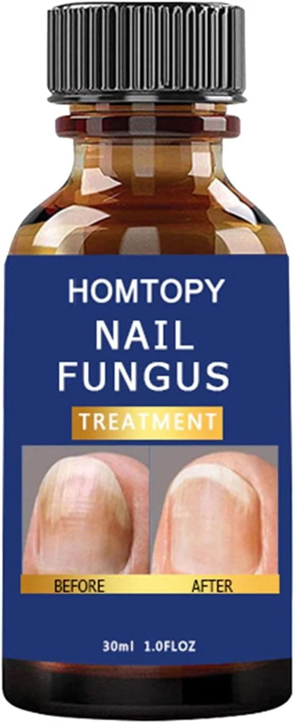 کیت ترمیم ناخن برای ناخن های طبیعی ترک خورده - تقویت کننده ناخن برای ناخن های نازک و رشد | پچ های تجدید کننده ناخن با فرمول حداکثر قدرت برای ناخن های آسیب دیده و تغییر رنگ داده