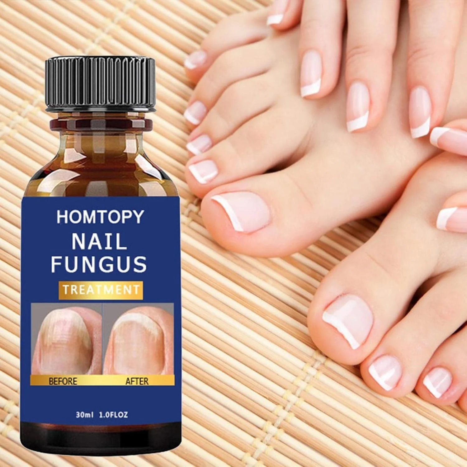 کیت ترمیم ناخن برای ناخن های طبیعی ترک خورده - تقویت کننده ناخن برای ناخن های نازک و رشد | پچ های تجدید کننده ناخن با فرمول حداکثر قدرت برای ناخن های آسیب دیده و تغییر رنگ داده