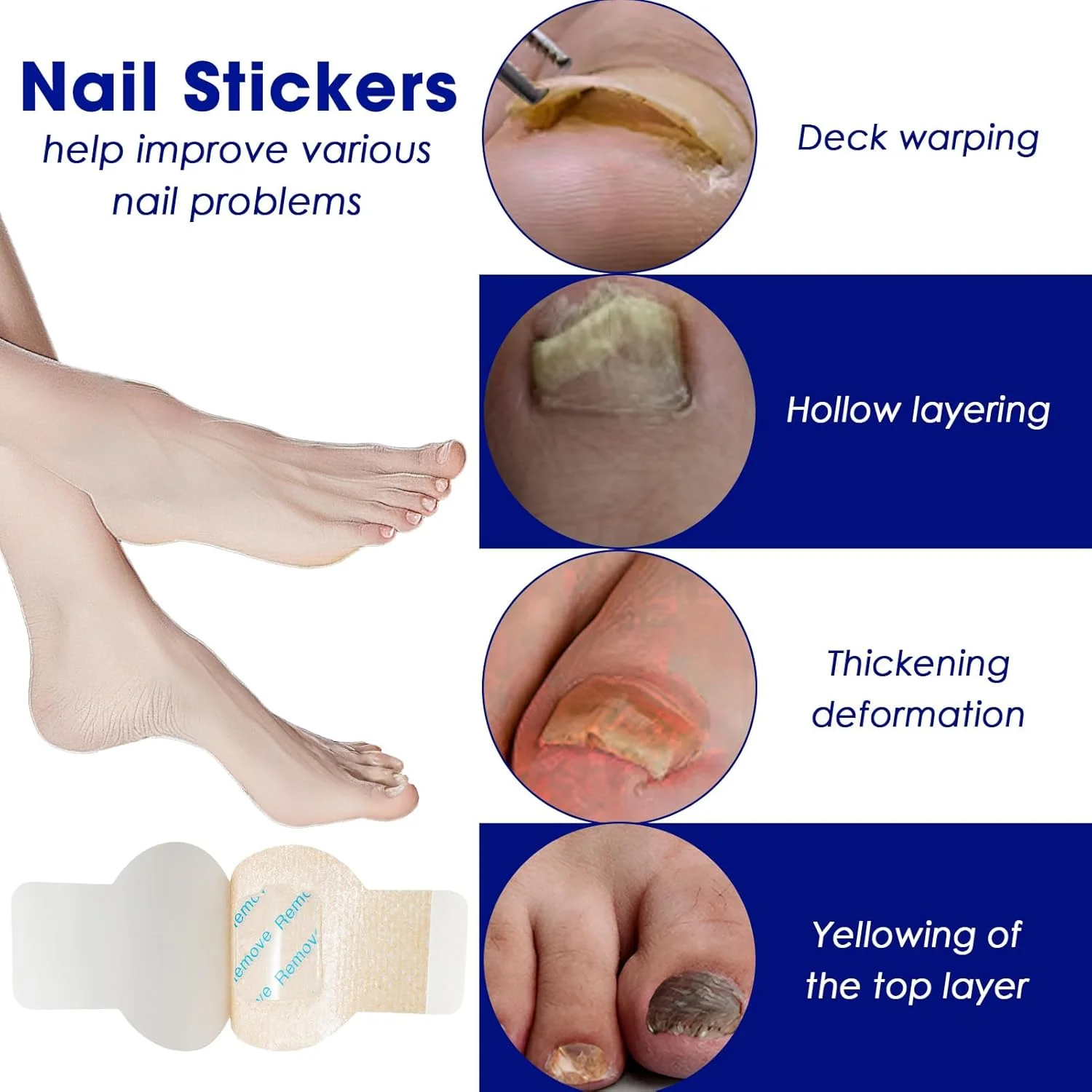 پد ترمیم ناخن قارچی، 21 عدد پد ترمیم ناخن قارچی برای ناخن پا، 8 ساعت ترمیم قارچ برای مراقبت از ناخن های آسیب دیده، ترمیم کننده تغییر رنگ، ضخامت و نرم کننده