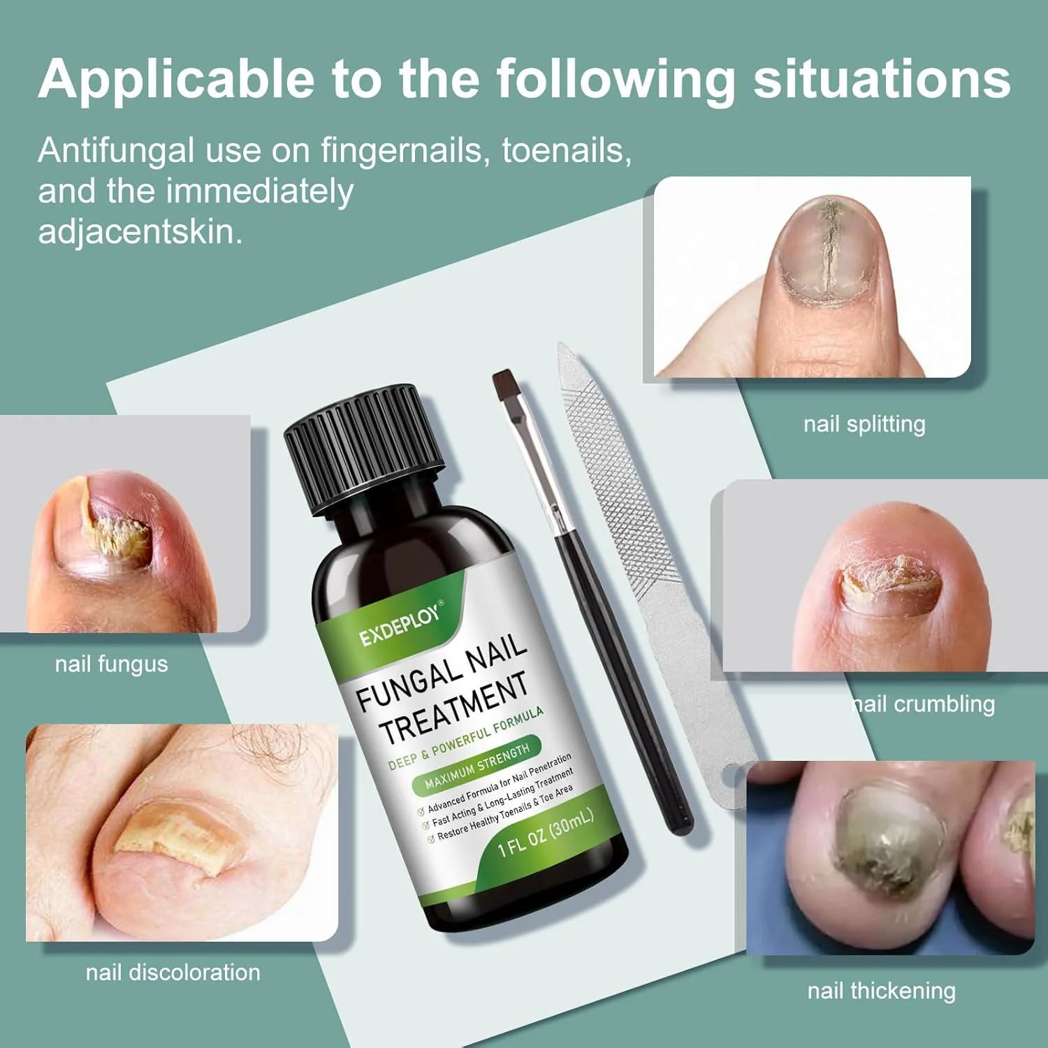 مجموعه 6 عددی درمان قارچ ناخن پا با قدرت فوق العاده حاوی 25% آندسیلنیک اسید برای ناخن های دست و پا به همراه روغن های طبیعی برای ناخن های ضخیم و آسیب دیده، درمان قارچ پا با قدرت فوق العاده