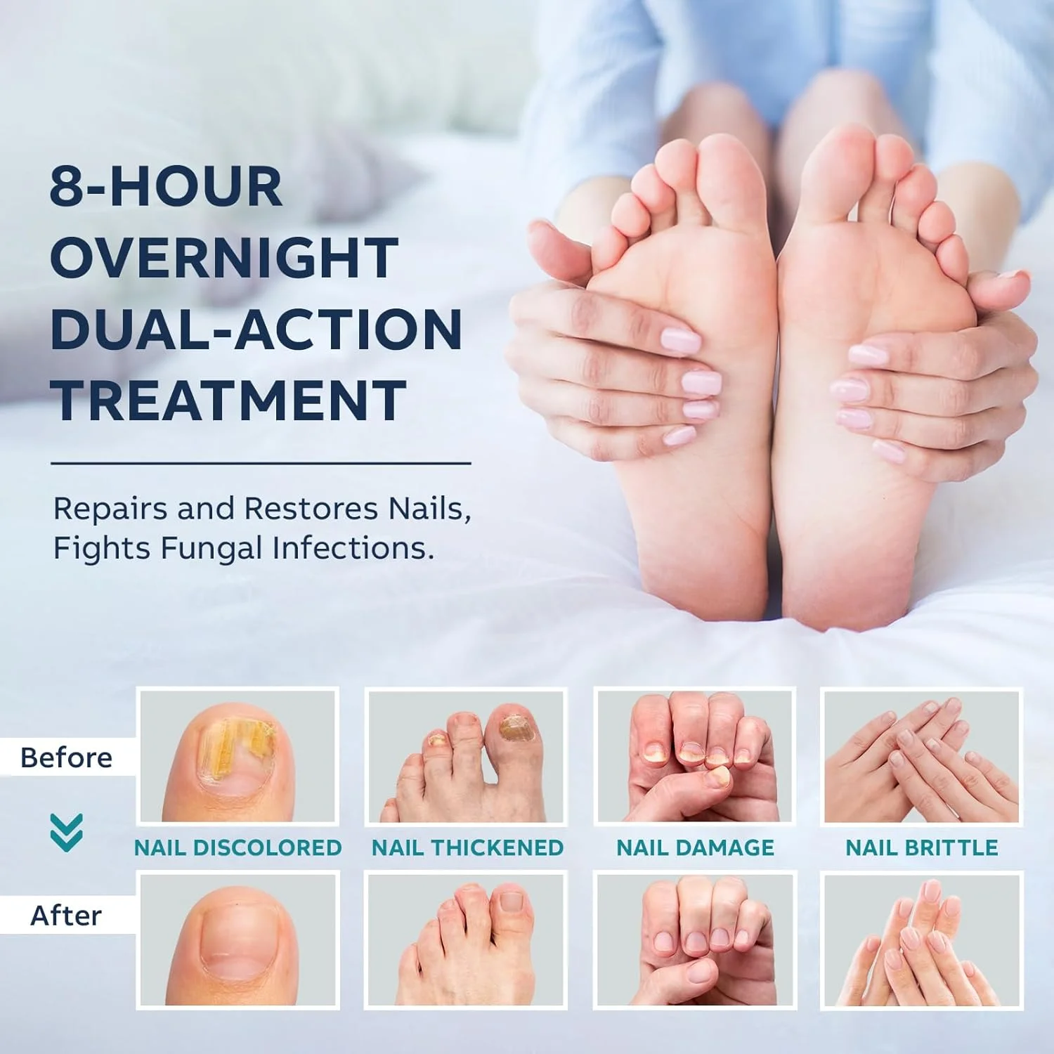 مجموعه درمان ناخن پا با قدرت مضاعف: محلول مایع ترمیم ناخن و پدها - تجدید کننده پدهای ناخن شبانه - قطره های سریع الاثر با آندسیلنیک اسید، روغن طبیعی برای ناخن های انگشتان دست و پا