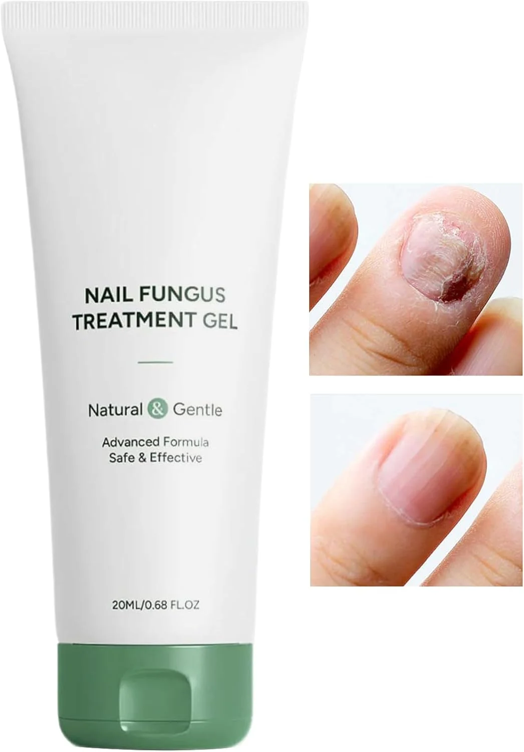 ژل ترمیم ناخن | ژل تقویت کننده ناخن با قدرت اضافی 20 میلی لیتر | محصولات مراقبت شخصی طبیعی برای ناخن های ضخیم، سفت، حساس، خشک، ترک خورده، شکسته، مناسب برای استفاده روزانه، مانیکور، پدیکور، مسافرت، شب و منزل