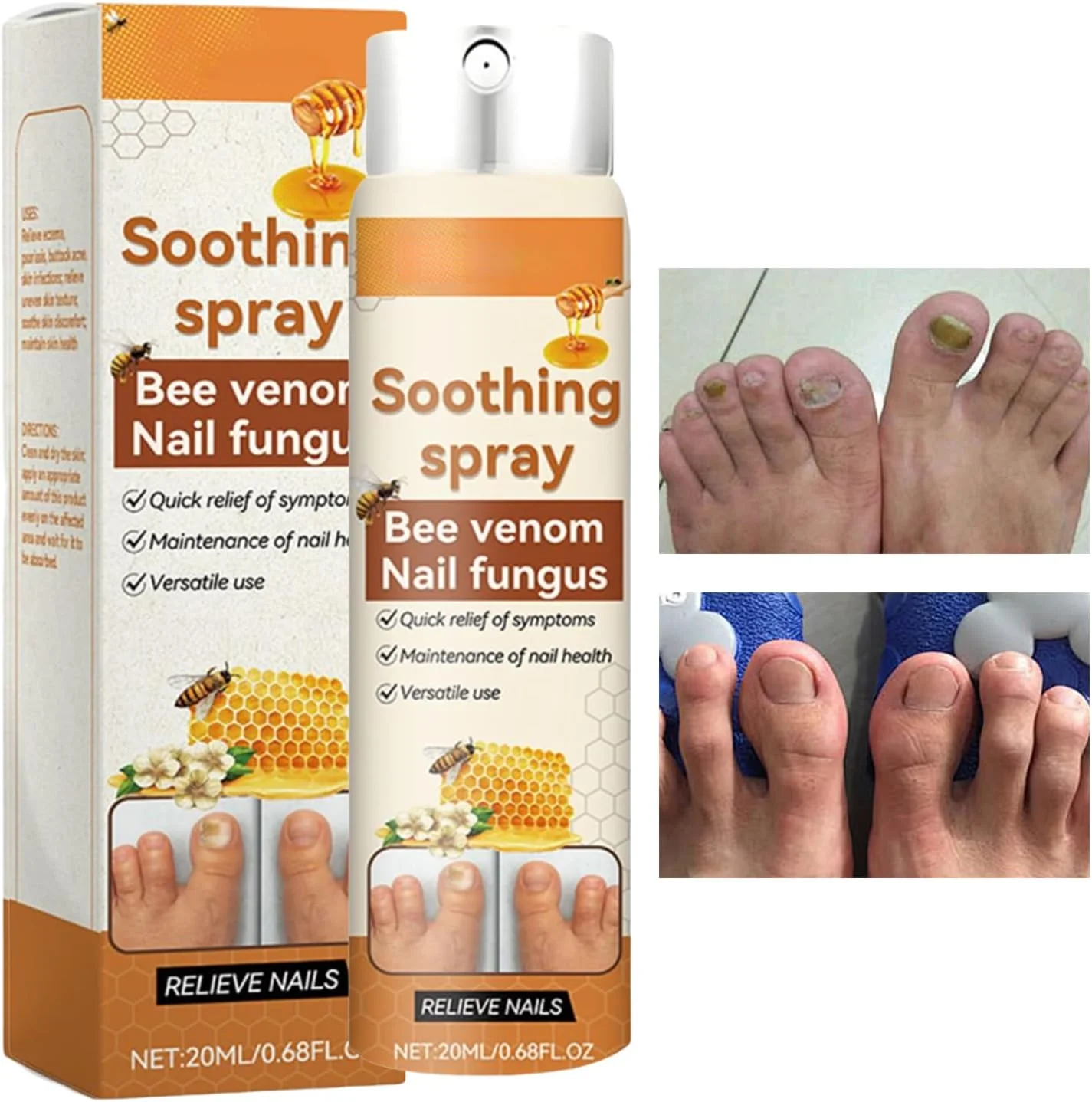 اسپری ترمیم ناخن 20 میلی لیتر | محلول تقویت کننده و احیا کننده برای استفاده بعد از مانیکور، مسافرت، آقایان، استفاده روزانه در فضای باز و منزل