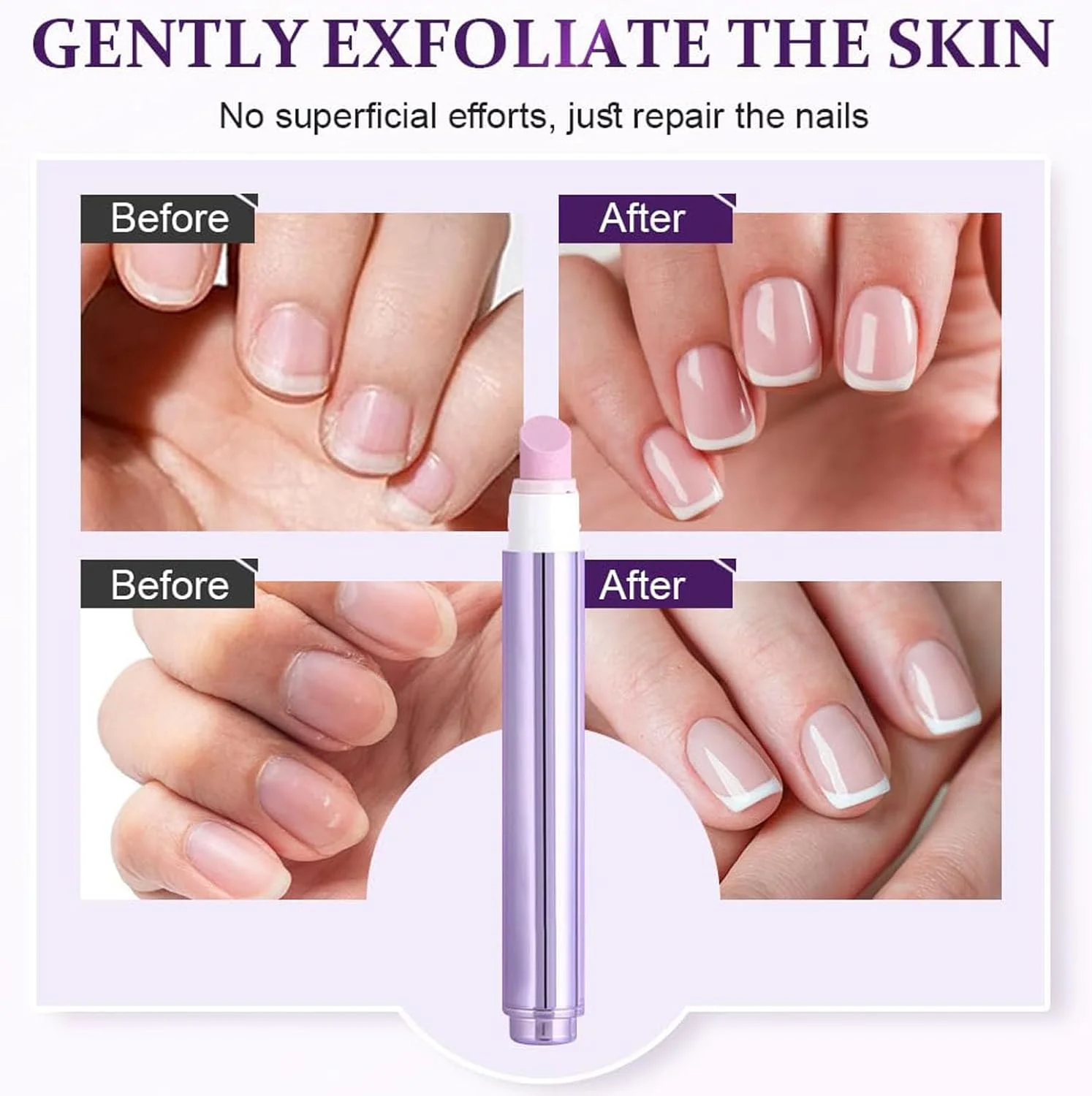 قلم عقب زن کوتیکول 3 در 1 با سرامیک، قلم روغن کوتیکول برای ناخن، روغن ناخن برای رشد و تقویت، نرم کننده کوتیکول برای ناخن، قلم های روغن مغذی ناخن، برای ناخن های خشک و آسیب دیده و ریشه دار (1 عدد)