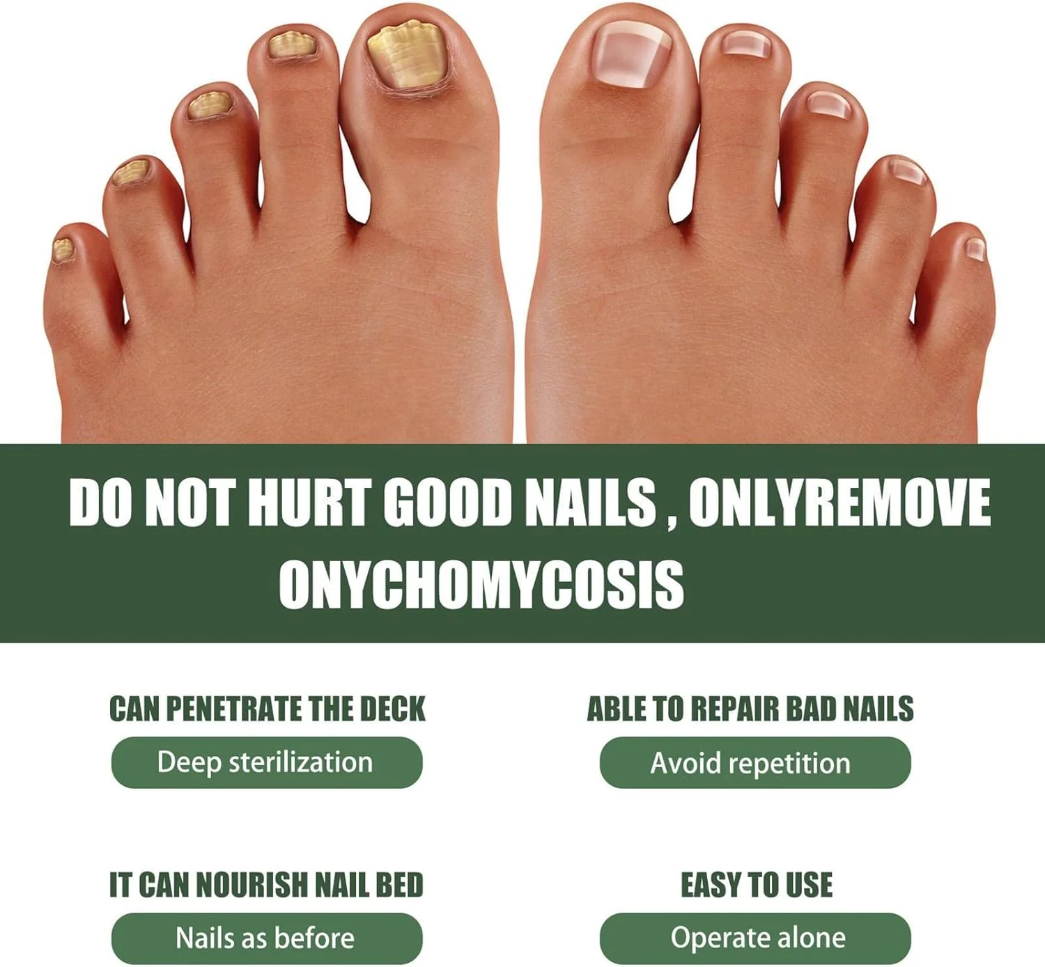 محلول ترمیم ناخن، ترمیم و تقویت ناخن ها، مراقبت از ناخن برای ناخن های آسیب دیده، محلول ترمیم ناخن 30 میلی لیتری برای آبرسانی، ناخن های ترک خورده و شکافته محلول ترمیم ناخن، ترمیم و تقویت ناخن ها، مراقبت از ناخن برای ناخن های آسیب دیده، محلول ترمیم ناخن 30 میلی لیتری برای آبرسانی، ناخن های ترک خورده و شکافته