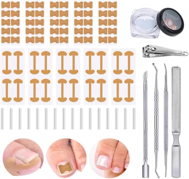 مجموعه اصلاح کننده ناخن پا فرورفته PINKE، با نوارهای تنفسی ناخن پا فرورفته، پد اصلاح کننده ناخن های منحنی، سوهان بدون درد و ابزارهای پدیکور بالابر برای اصلاح ناخن پا مردانه و زنانه
