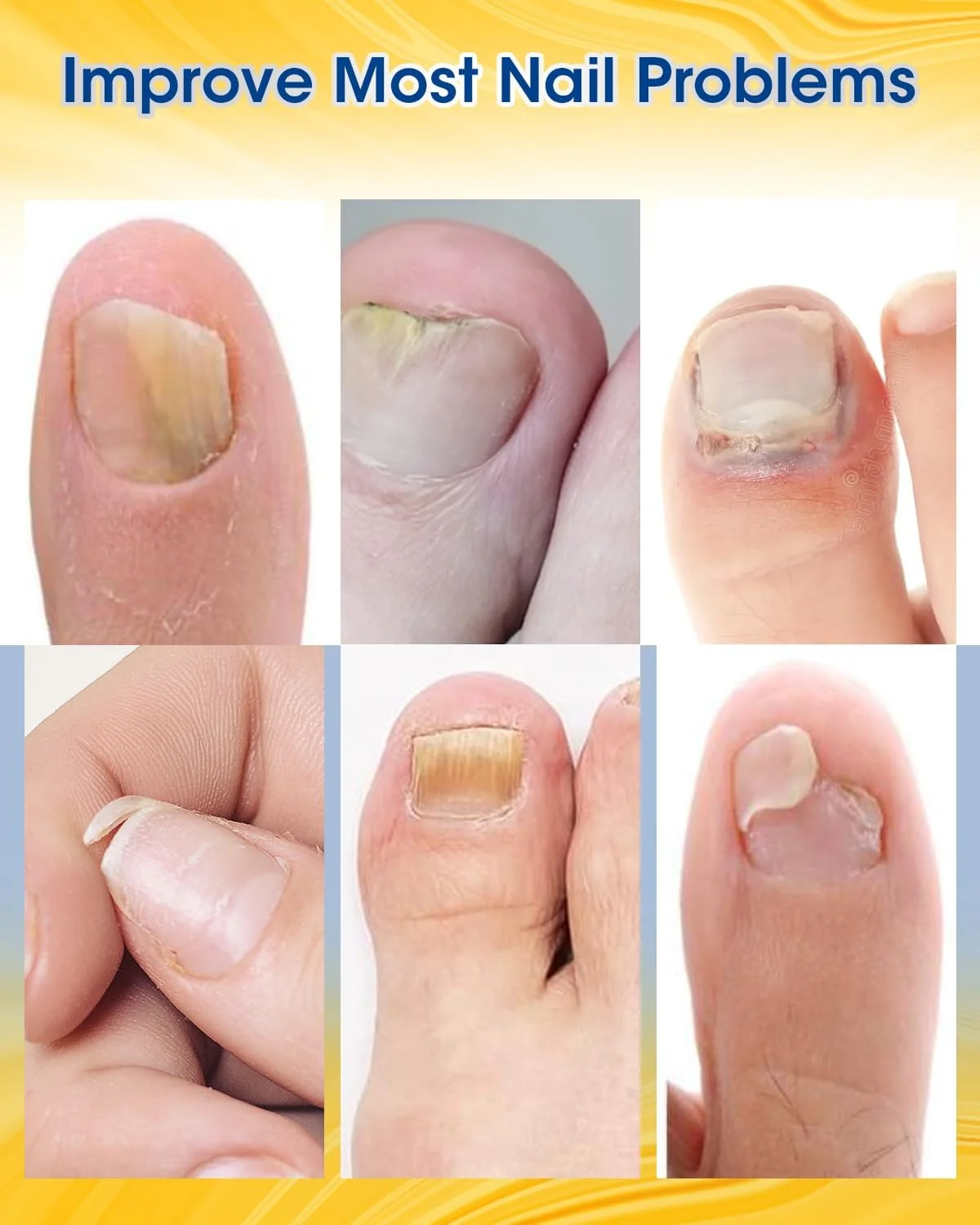پد ترمیم ناخن مایمولایک، قدرت اضافی، 28 عدد، ترمیم ناخن برای ناخن های آسیب دیده، پد تجدید کننده ناخن پا 8 ساعته در شب، ظاهر ناخن های تغییر رنگ داده، ضخیم و آسیب دیده را ترمیم می کند.