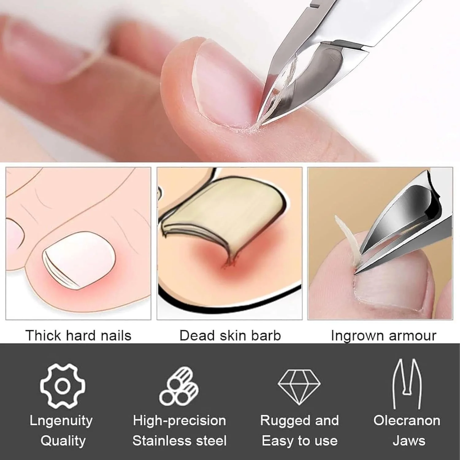 کیت ترمیم ناخن های قارچی با قدرت اضافی - درمان 24 ساعته روز و شب برای ناخن های پا و دست + قیچی انحنا دار حرفه ای - محلول سریع الاثر برای ناخن های ضخیم و تغییر رنگ داده کیت ترمیم ناخن های قارچی با قدرت اضافی - درمان 24 ساعته روز و شب برای ناخن های پا و دست + قیچی انحنا دار حرفه ای - محلول سریع الاثر برای ناخن های ضخیم و تغییر رنگ داده