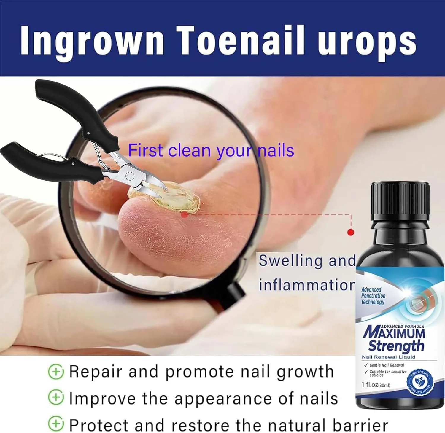 کیت ترمیم ناخن های قارچی با قدرت اضافی - درمان 24 ساعته روز و شب برای ناخن های پا و دست + قیچی انحنا دار حرفه ای - محلول سریع الاثر برای ناخن های ضخیم و تغییر رنگ داده کیت ترمیم ناخن های قارچی با قدرت اضافی - درمان 24 ساعته روز و شب برای ناخن های پا و دست + قیچی انحنا دار حرفه ای - محلول سریع الاثر برای ناخن های ضخیم و تغییر رنگ داده