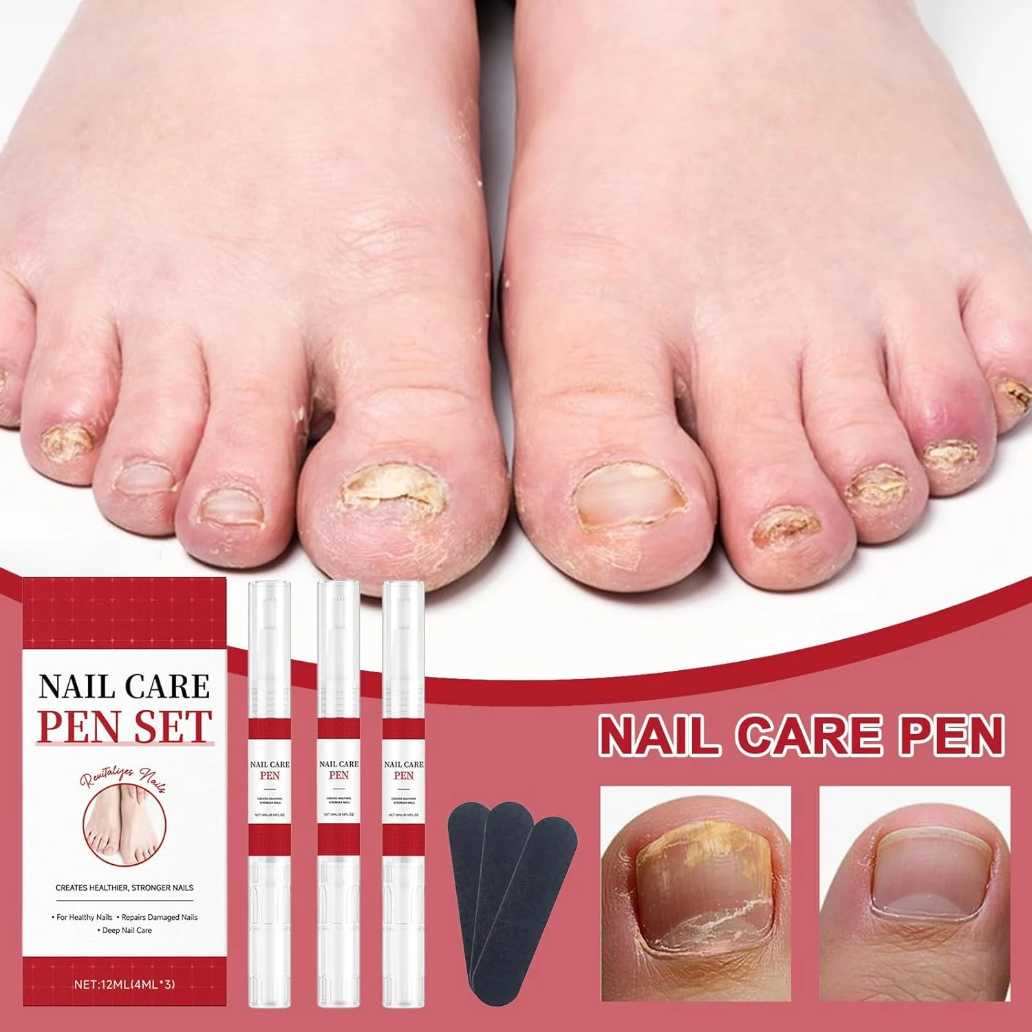 مراقبت از رشد ناخن | قلم تغذیه کننده ناخن 3 عددی - مراقبت از ناخن های آسیب دیده، برای مانیکور و پدیکور خانگی، سالن، بزرگسالان، زنان، مردان، سالمندان