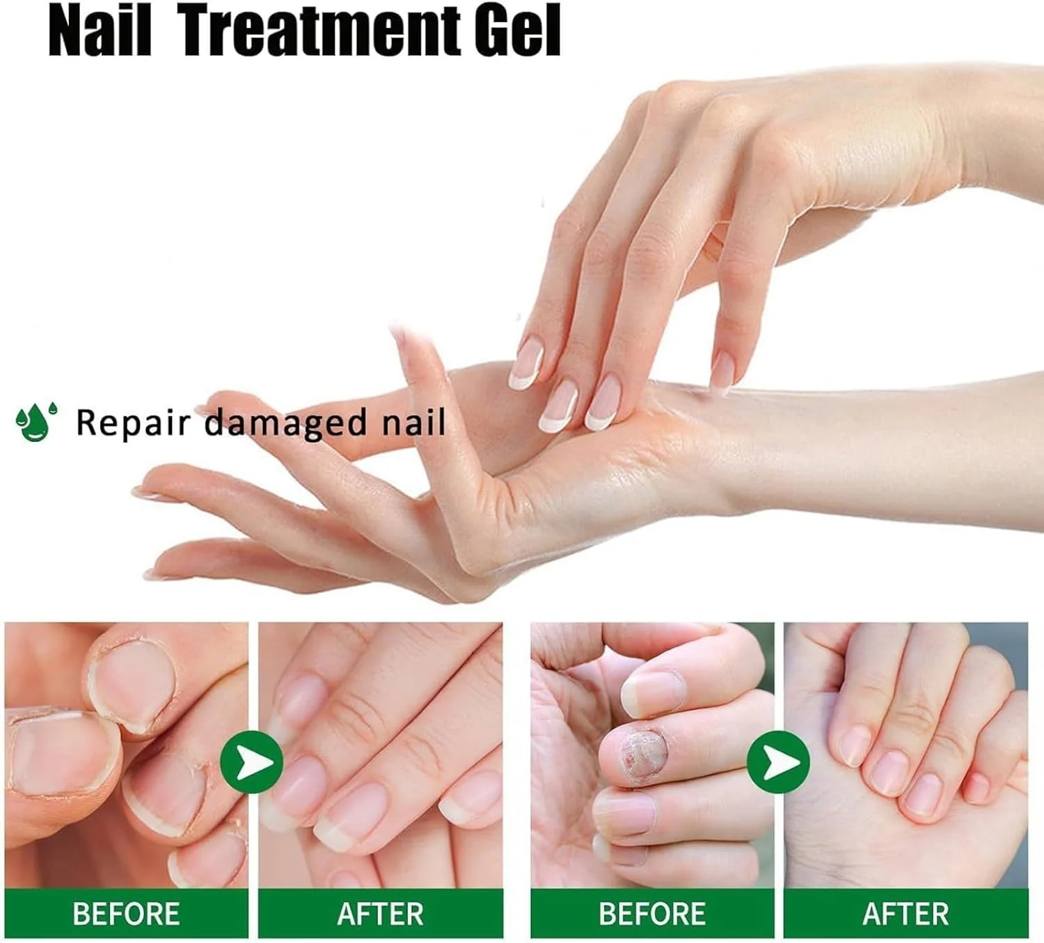 ژل ناخن | کرم ترمیم ناخن پا آسیب دیده و زرد 20 میلی لیتری | تقویت کننده و مراقبت از سلامت ناخن های آسیب دیده، شکننده، حساس، سفت برای استفاده روزانه، قبل از خواب، حمام، مسافرت، شب، منزل، ورزش، مناسب برای آقایان و بانوان ژل ناخن | کرم ترمیم ناخن پا آسیب دیده و زرد 20 میلی لیتری | تقویت کننده و مراقبت از سلامت ناخن های آسیب دیده، شکننده، حساس، سفت برای استفاده روزانه، قبل از خواب، حمام، مسافرت، شب، منزل، ورزش، مناسب برای آقایان و بانوان