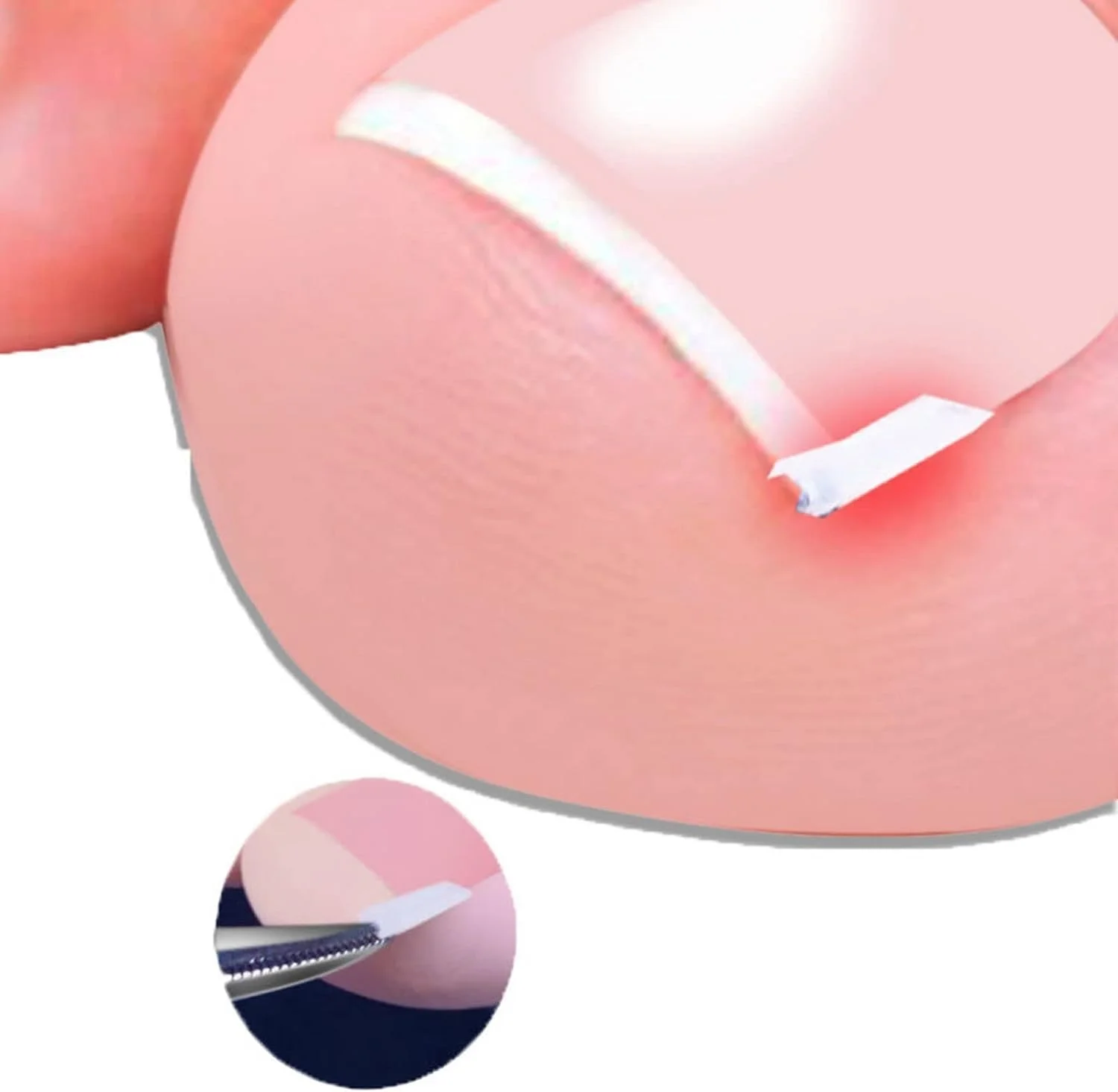 ۱۰ عدد نوار سفید برای اصلاح ناخن پا فرورفته، نوار صاف کننده ناخن پا فرورفته، نوار صاف کننده ناخن پا ضخیم برای ابزار و لوازم جانبی مراقبت از پای مردان و زنان ۱۰ عدد نوار سفید برای اصلاح ناخن پا فرورفته، نوار صاف کننده ناخن پا فرورفته، نوار صاف کننده ناخن پا ضخیم برای ابزار و لوازم جانبی مراقبت از پای مردان و زنان