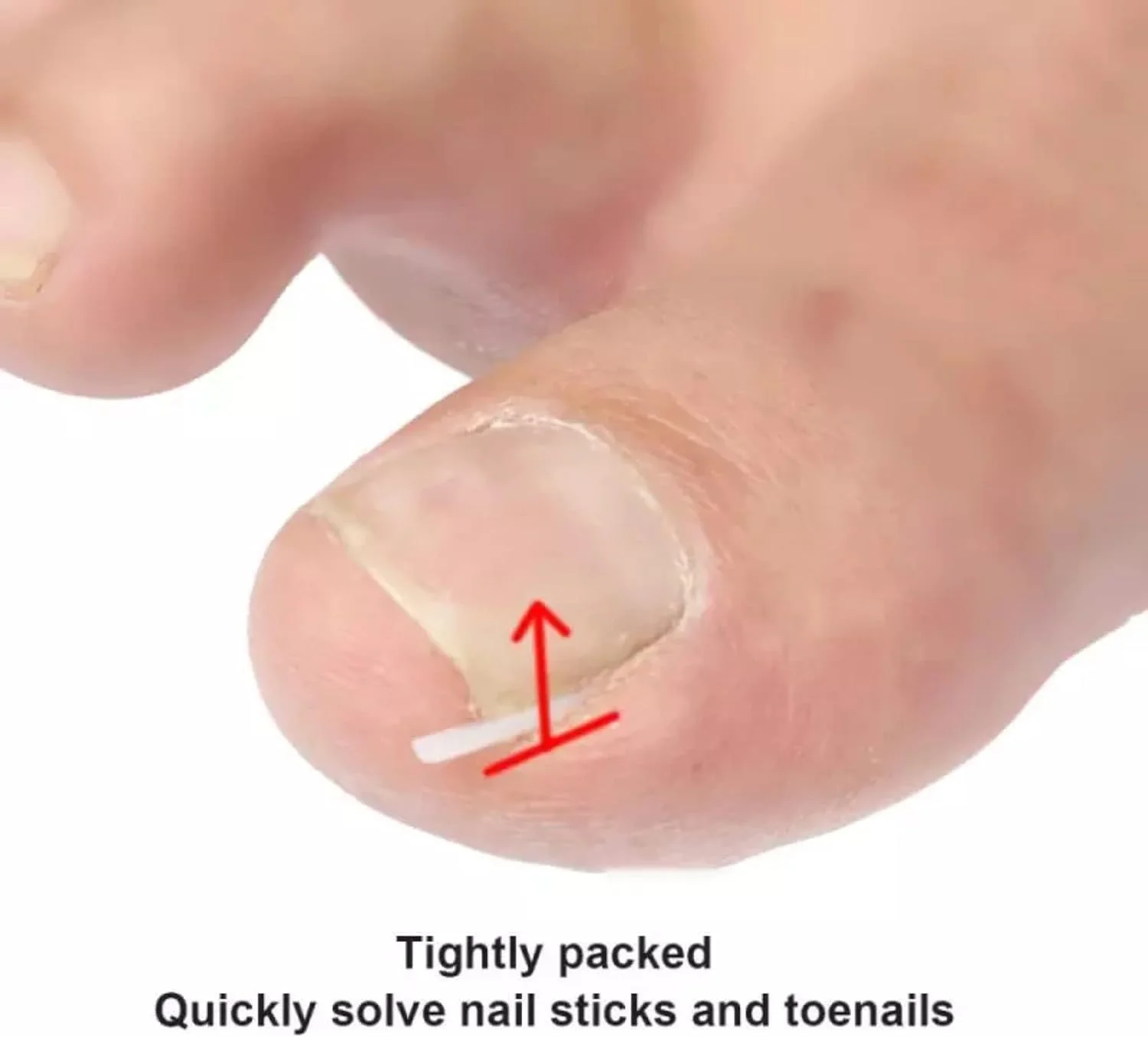 ۱۰ عدد نوار سفید برای اصلاح ناخن پا فرورفته، نوار صاف کننده ناخن پا فرورفته، نوار صاف کننده ناخن پا ضخیم برای ابزار و لوازم جانبی مراقبت از پای مردان و زنان ۱۰ عدد نوار سفید برای اصلاح ناخن پا فرورفته، نوار صاف کننده ناخن پا فرورفته، نوار صاف کننده ناخن پا ضخیم برای ابزار و لوازم جانبی مراقبت از پای مردان و زنان