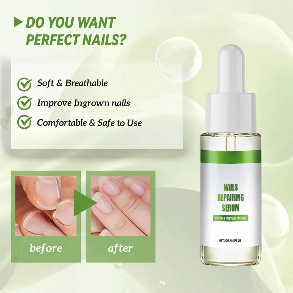 سرم ترمیم ناخن آزونی برای ناخن های آسیب دیده، درمان تقویت کننده و رشد 7 روزه، تقویت کننده ناخن برای ناخن های آسیب دیده، سخت کننده ناخن، درمان رشد ناخن پا، محلول ترمیم ناخن (20 میلی لیتر)