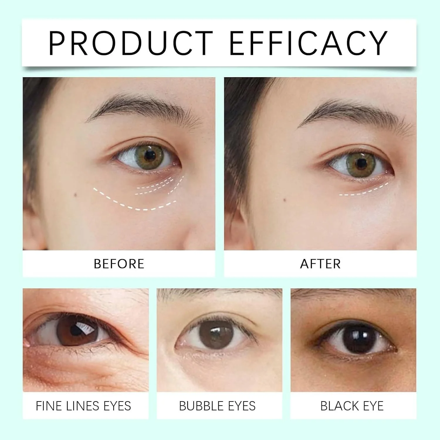 کرم دور چشم Azonee برای سیاهی و پف زیر چشم، کرم ترمیم کننده ضد پیری با سنتلا آسیاتیکا، سفت کننده و صاف کننده فوری چشم، کاهش دهنده پف، خطوط ریز و چروک (100 گرم)