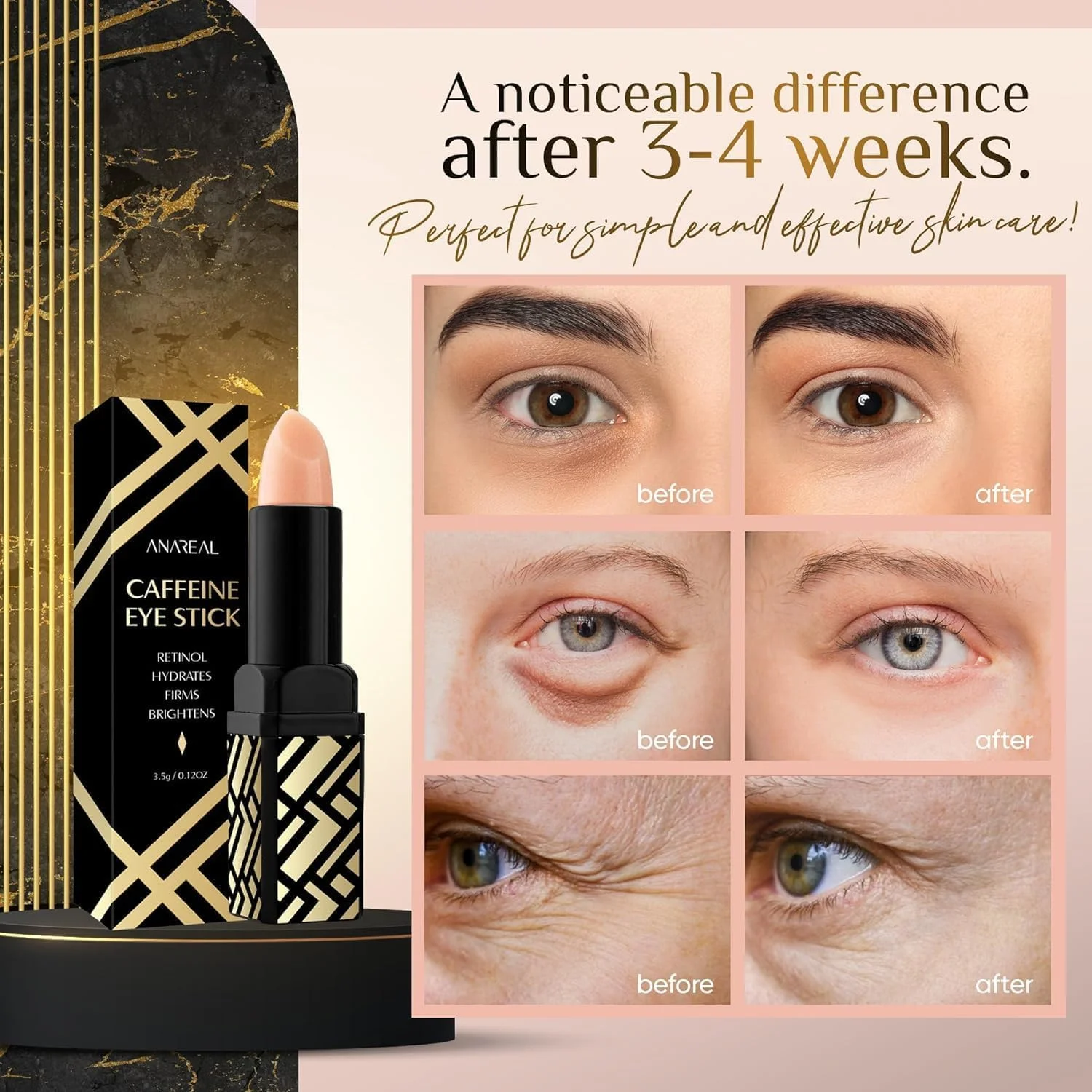 بالم دور چشم کافئین ANAREAL: کرم استیکی آبرسان و روشن کننده دور چشم برای سیاهی و پف، درمان ضد چروک پوست کره ای با رتینول، درخشش فوری خنک کننده برای چشم، صورت و پف
