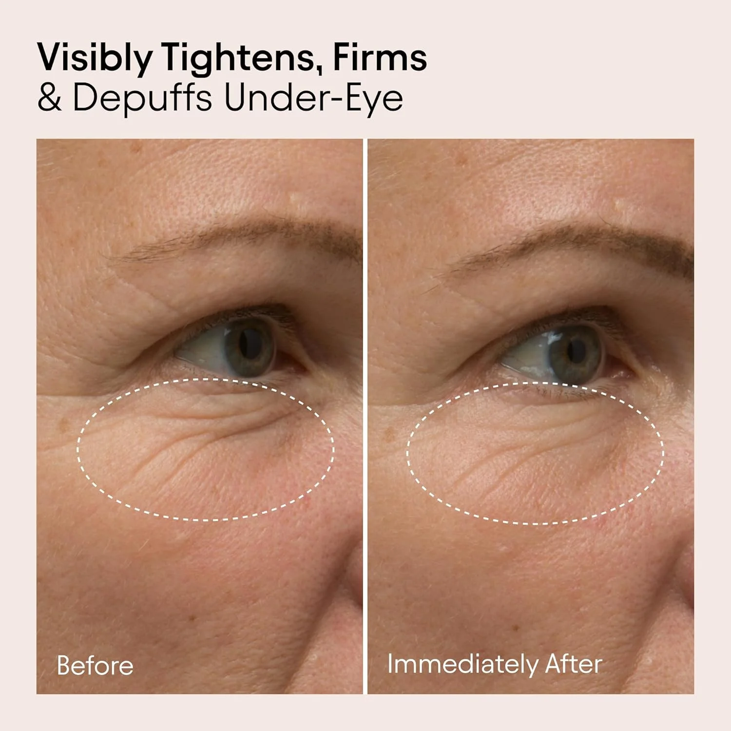 بالم دور چشم Alpyn حاوی باکوچیول و کافئین، کاهش ظاهر خطوط ریز و چروک، کاهش ظاهر پف و هدف قرار دادن سیاهی دور چشم، 14 میلی لیتر