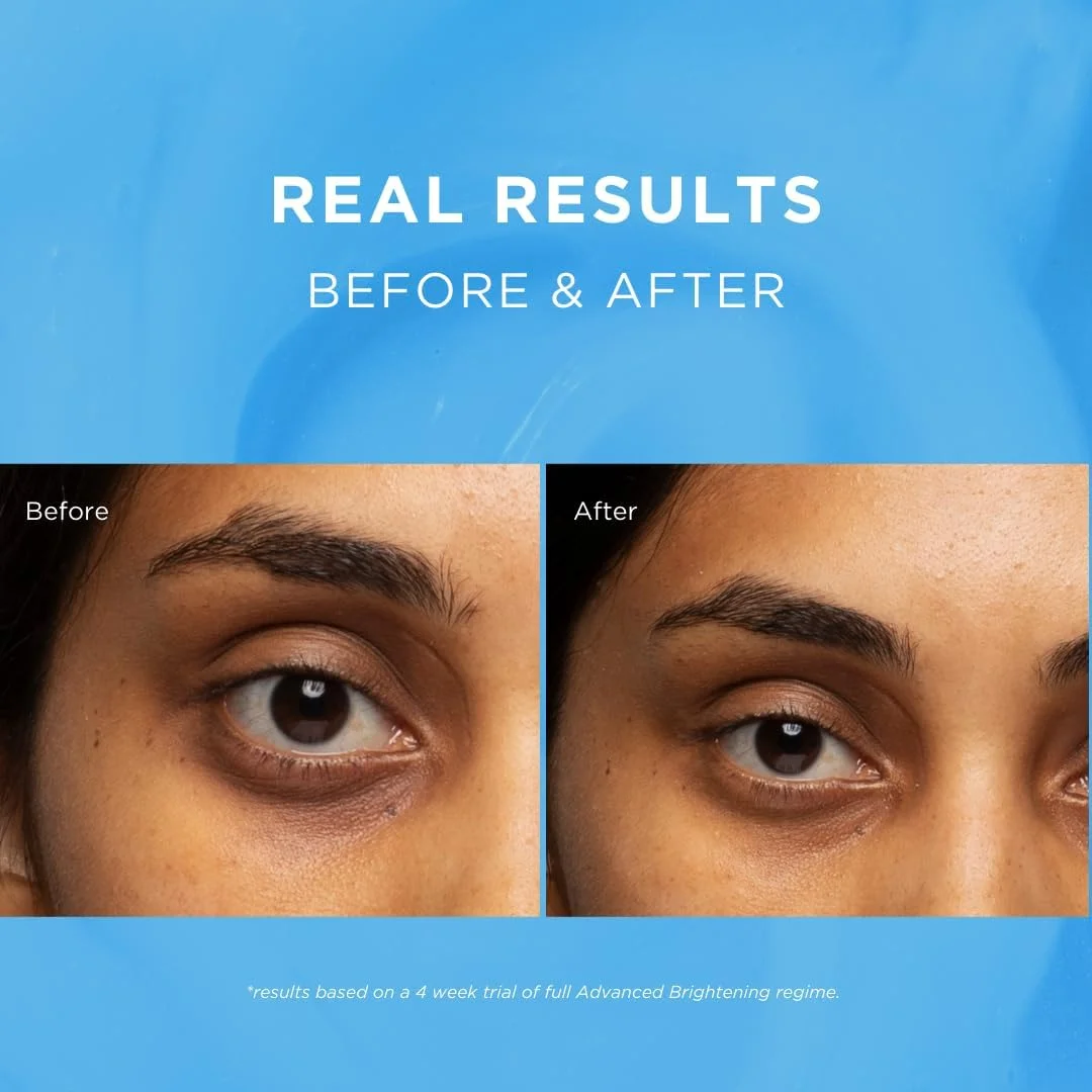 کرم روز دور چشم روشن کننده پیشرفته Fade Out - SPF 20 - روشن و یکنواخت کننده پوست - کاهش ظاهر حلقه های تیره - محافظت در برابر UVA/UVB - روشن کننده ناحیه زیر چشم - جذب سریع - 15 میلی لیتر کرم روز دور چشم روشن کننده پیشرفته Fade Out - SPF 20 - روشن و یکنواخت کننده پوست - کاهش ظاهر حلقه های تیره - محافظت در برابر UVA/UVB - روشن کننده ناحیه زیر چشم - جذب سریع - 15 میلی لیتر