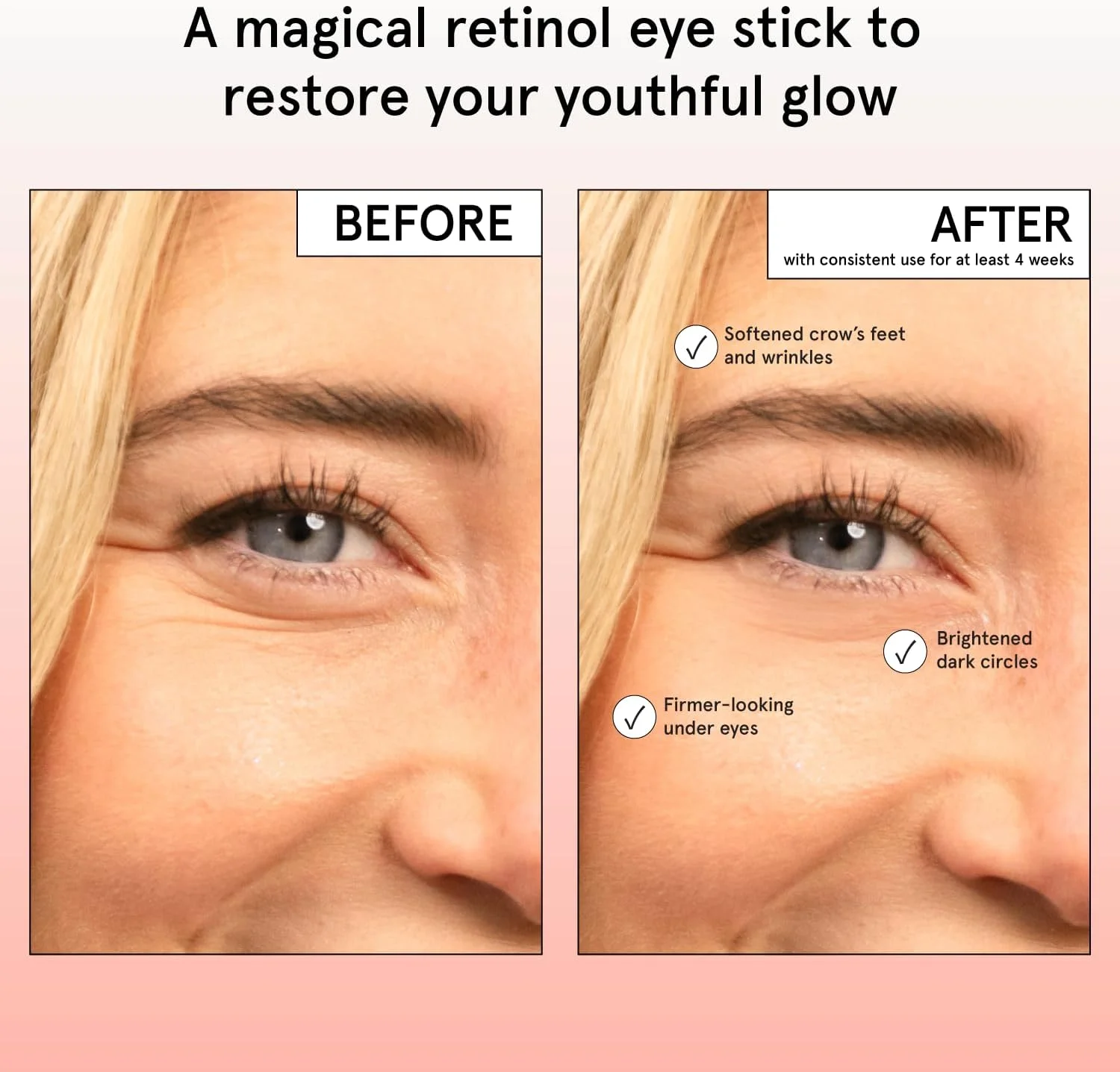 بالم روشن کننده زیر چشم گریس اند استلا - لوازم بهداشتی سایز مسافرتی - کرم دور چشم حاوی رتینول و کافئین برای تیرگی، پف و چروک - احیا کننده و آبرسان - مراقبت از پوست وگان (3.5 گرم) بالم روشن کننده زیر چشم گریس اند استلا - لوازم بهداشتی سایز مسافرتی - کرم دور چشم حاوی رتینول و کافئین برای تیرگی، پف و چروک - احیا کننده و آبرسان - مراقبت از پوست وگان (3.5 گرم)