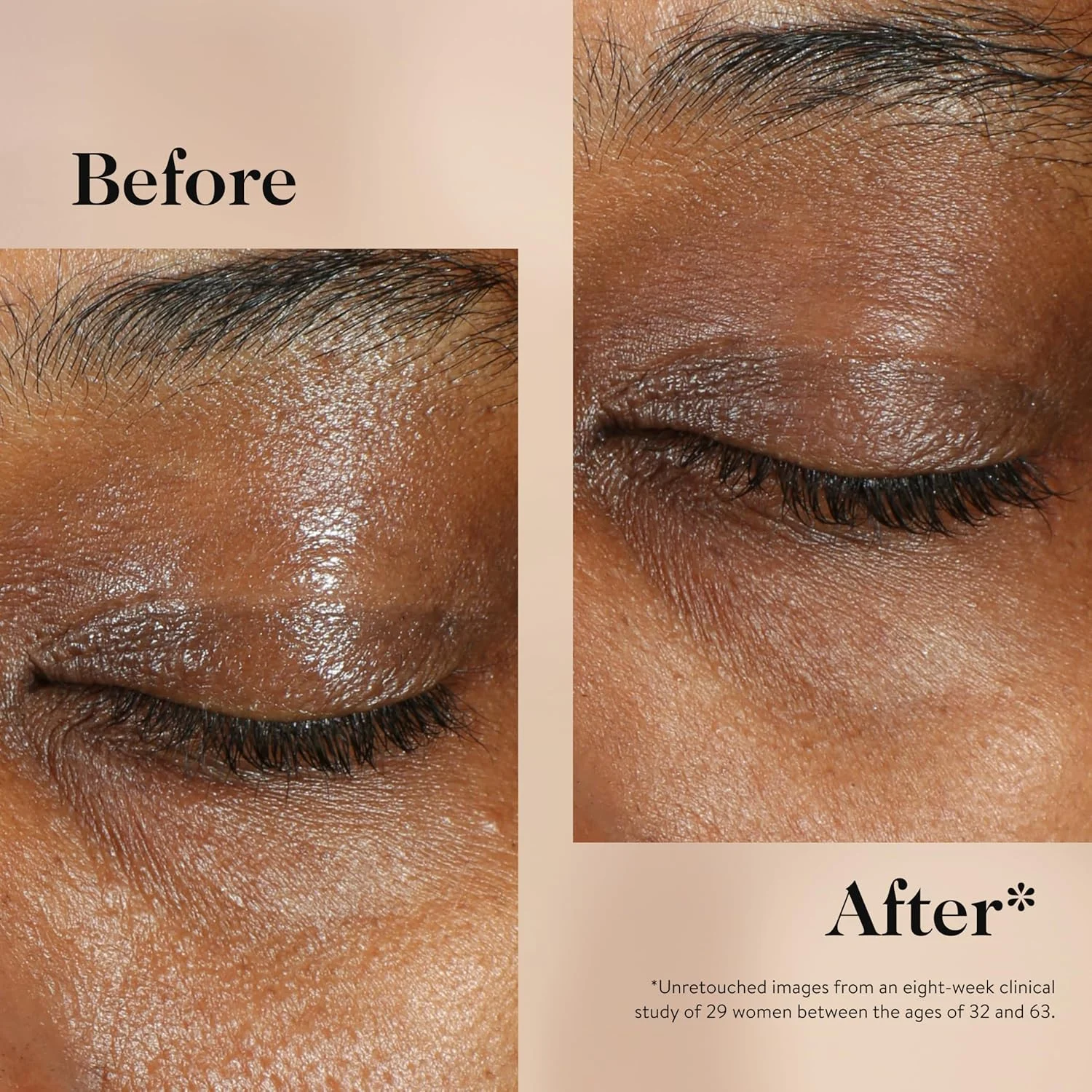 کرم دور چشم ویتامین C گوپ بیوتی | کرم اصلاح کننده رنگ برای تیرگی دور چشم | کمک به صاف کردن چین و چروک و کاهش پف زیر چشم | 15 میلی لیتر