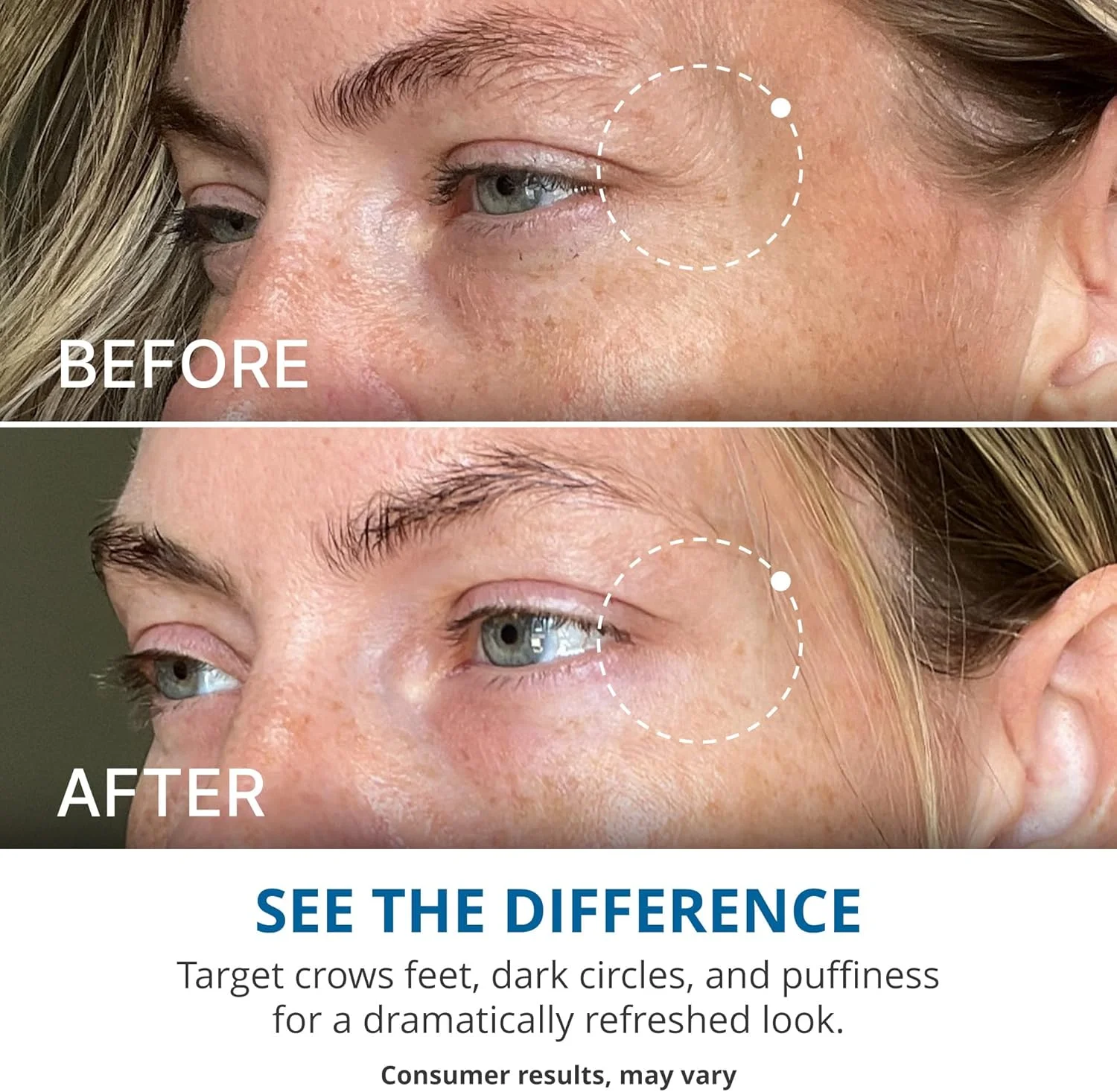 کرم دور چشم ترمیم کننده پیشرفته goPure - کرم دور چشم برای پف، سیاهی و حلقه های تیره، بهبود قابل مشاهده ظاهر خطوط ریز، چین و چروک و پنجه کلاغی - 17 میلی لیتر کرم دور چشم ترمیم کننده پیشرفته goPure - کرم دور چشم برای پف، سیاهی و حلقه های تیره، بهبود قابل مشاهده ظاهر خطوط ریز، چین و چروک و پنجه کلاغی - 17 میلی لیتر