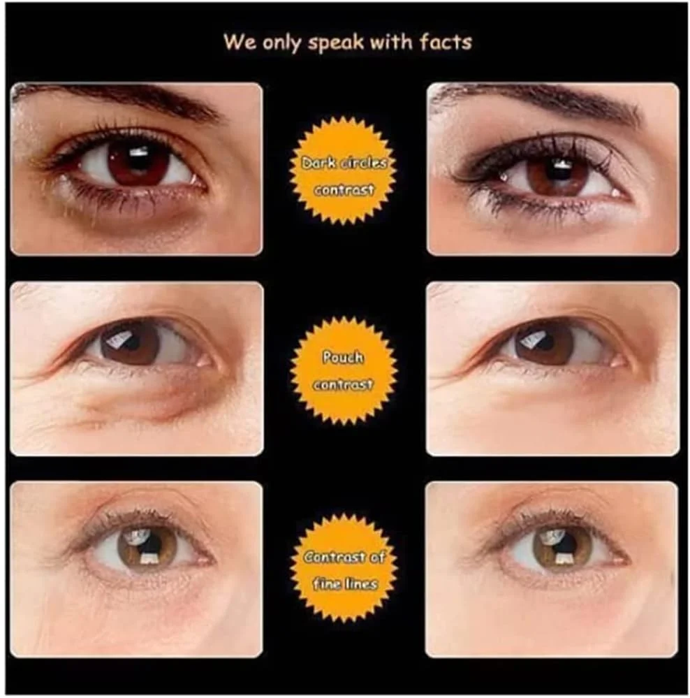 کرم دور چشم کانزا - ترمیم و درمان دور چشم | پروتئین ابریشم، ضد چروک و سفت کننده پوست دور چشم | کاهش ظاهر خطوط ریز، ضد پیری، تیرگی و پف | کرم مراقبت از چشم | 20 گرم کرم دور چشم کانزا - ترمیم و درمان دور چشم | پروتئین ابریشم، ضد چروک و سفت کننده پوست دور چشم | کاهش ظاهر خطوط ریز، ضد پیری، تیرگی و پف | کرم مراقبت از چشم | 20 گرم