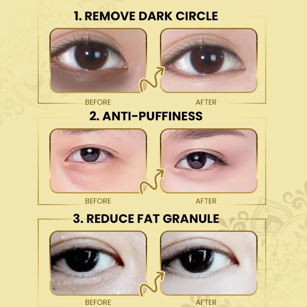 ماسک دور چشم کلاژن کانزا 60 عددی (30 جفت)، پچ زیر چشم برای پف و درمان ضد پیری، کاهش سیاهی دور چشم، پف، چین و چروک، پچ هیدروژل چشم، ست ماسک زیر چشم ماسک دور چشم کلاژن کانزا 60 عددی (30 جفت)، پچ زیر چشم برای پف و درمان ضد پیری، کاهش سیاهی دور چشم، پف، چین و چروک، پچ هیدروژل چشم، ست ماسک زیر چشم