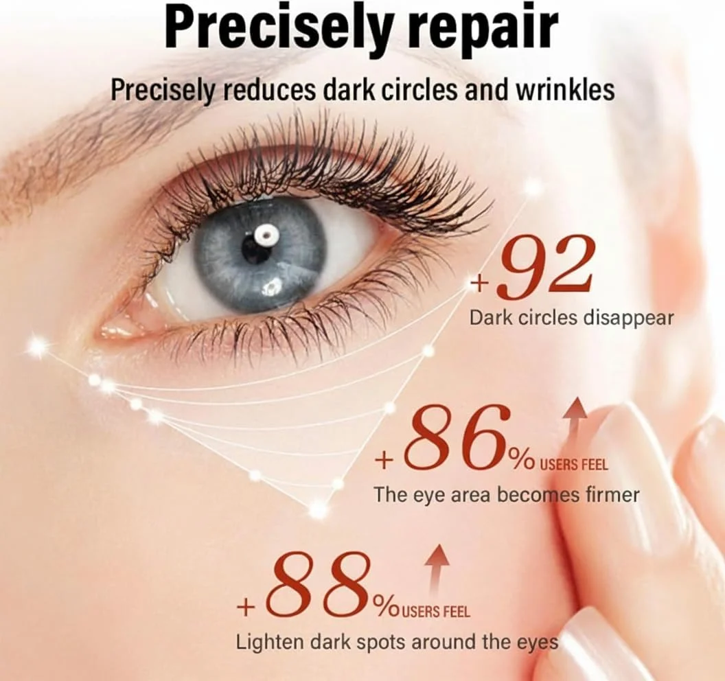 کرم دور چشم کافئین NALACAL برای تیرگی و پف زیر چشم | سفت کننده و آبرسان پوست زیر چشم با پلی فنول های چای | سبک و با جذب سریع، 30 میلی لیتر کرم دور چشم کافئین NALACAL برای تیرگی و پف زیر چشم | سفت کننده و آبرسان پوست زیر چشم با پلی فنول های چای | سبک و با جذب سریع، 30 میلی لیتر