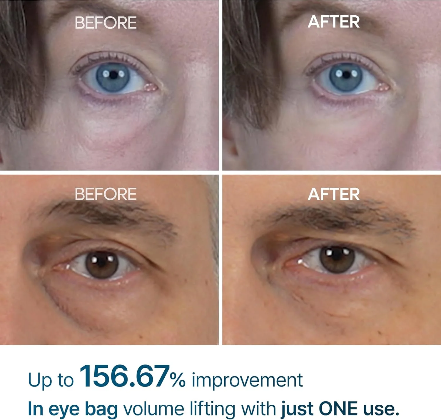 کرم دور چشم دکتر ملاکسین Eyephalt برای پف، سیاهی دور چشم و خطوط ریز، ضد چروک، مرطوب کننده دور چشم ضد پیری EGF با نیاسینامید و سرامید 10 میلی لیتر کرم دور چشم دکتر ملاکسین Eyephalt برای پف، سیاهی دور چشم و خطوط ریز، ضد چروک، مرطوب کننده دور چشم ضد پیری EGF با نیاسینامید و سرامید 10 میلی لیتر