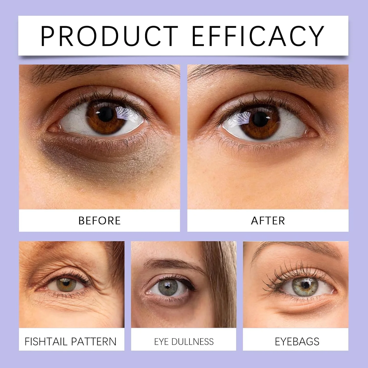 کرم دور چشم غنی شده با کلاژن و زهر زنبور عسل، کرم دور چشم برای رفع چین و چروک، پف و تیرگی، بهبود رنگ ناهموار پوست، کرم آبرسان و سفت کننده دور چشم (20 گرم) کرم دور چشم غنی شده با کلاژن و زهر زنبور عسل، کرم دور چشم برای رفع چین و چروک، پف و تیرگی، بهبود رنگ ناهموار پوست، کرم آبرسان و سفت کننده دور چشم (20 گرم)