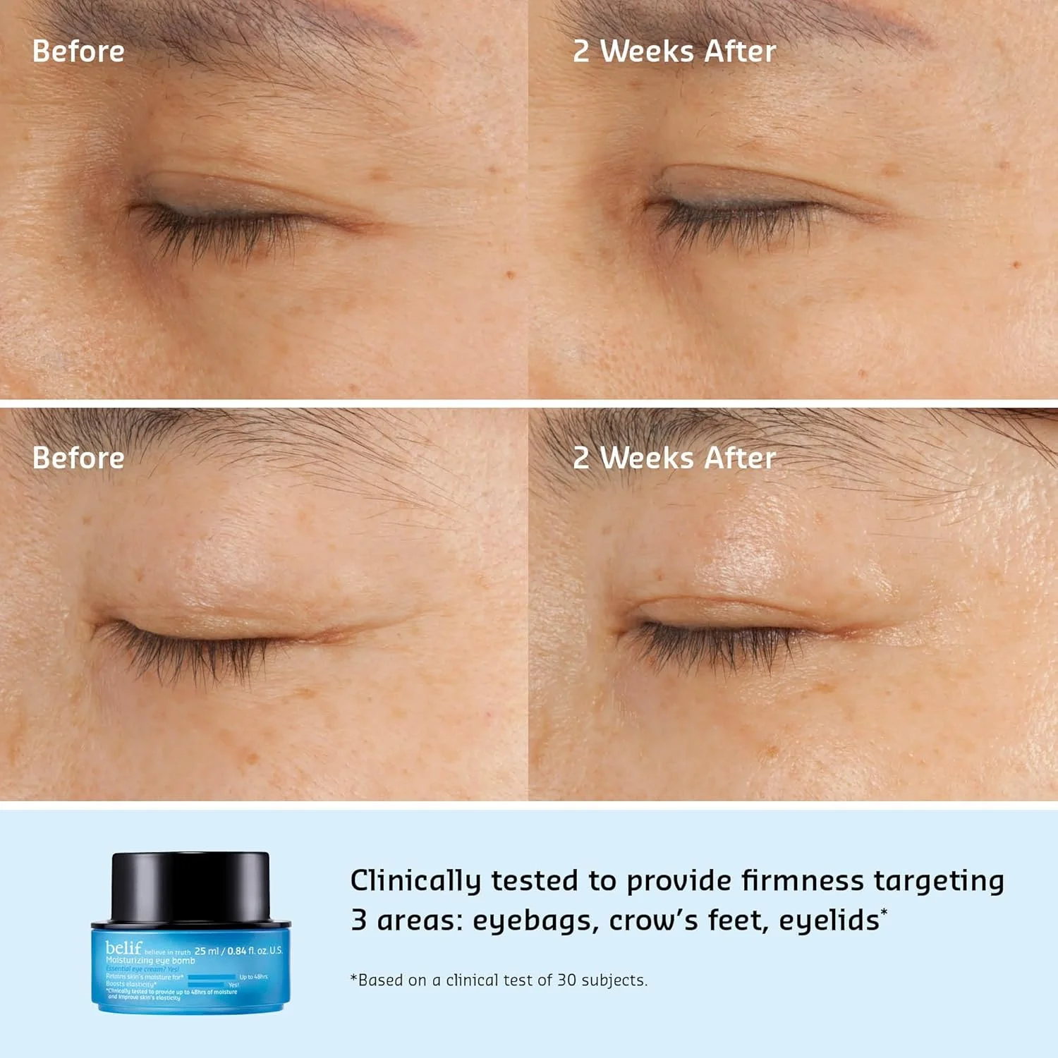 کرم دور چشم مرطوب کننده بلیف حاوی اسکوالان، 26 ساعت رطوبت رسانی، افزایش خاصیت ارتجاعی، افزایش استحکام پوست، مناسب برای خشکی و از دست دادن سفتی، برای انواع پوست معمولی، خشک، مختلط و چرب