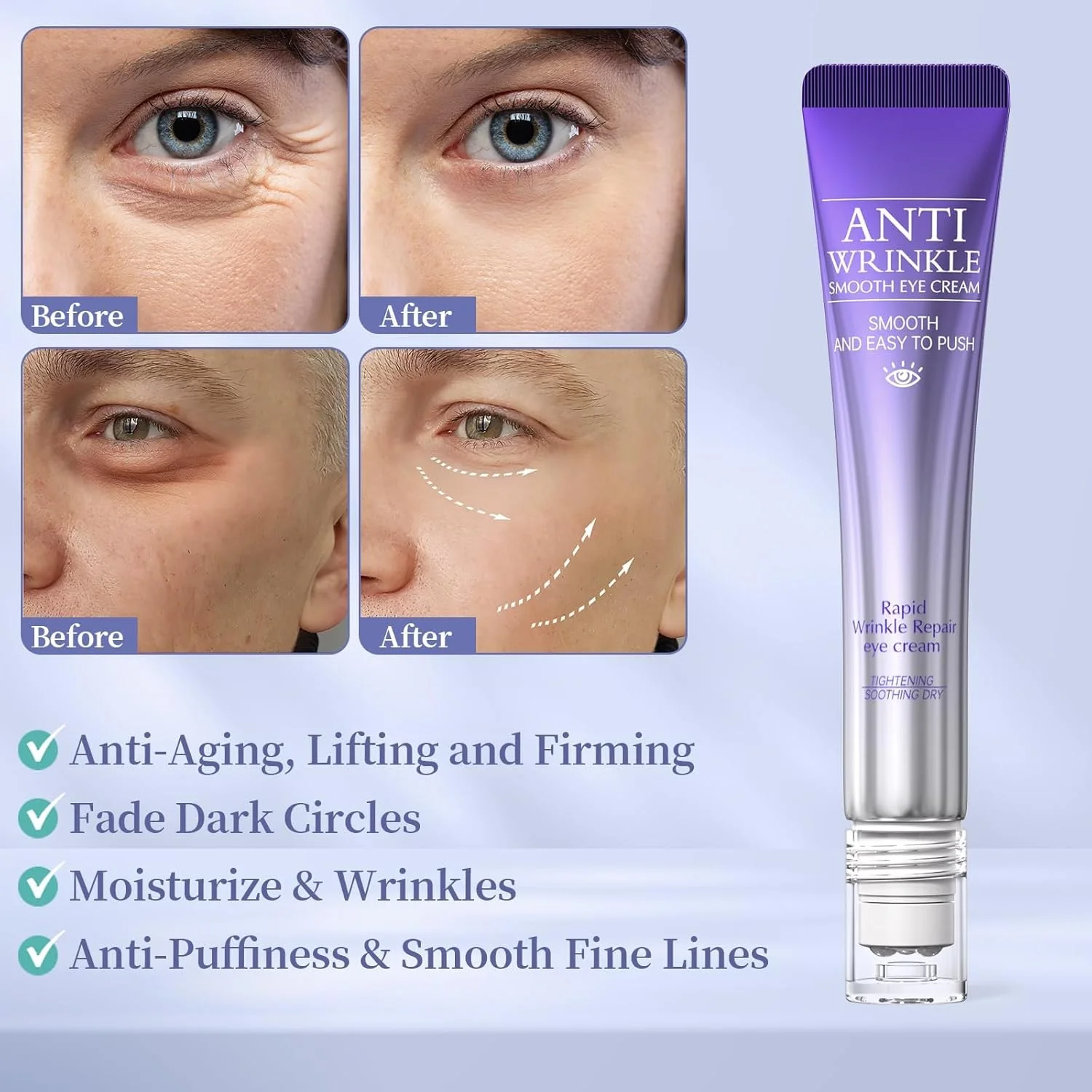 کرم دور چشم رتینول با توپ ماساژور، درمان ضد پیری دور چشم، کاهش تیرگی، پف، خطوط ریز و چین و چروک، سفت کننده و آبرسان ناحیه زیر چشم، شاداب کننده چشم های خسته، درخشش جوانی کرم دور چشم رتینول با توپ ماساژور، درمان ضد پیری دور چشم، کاهش تیرگی، پف، خطوط ریز و چین و چروک، سفت کننده و آبرسان ناحیه زیر چشم، شاداب کننده چشم های خسته، درخشش جوانی