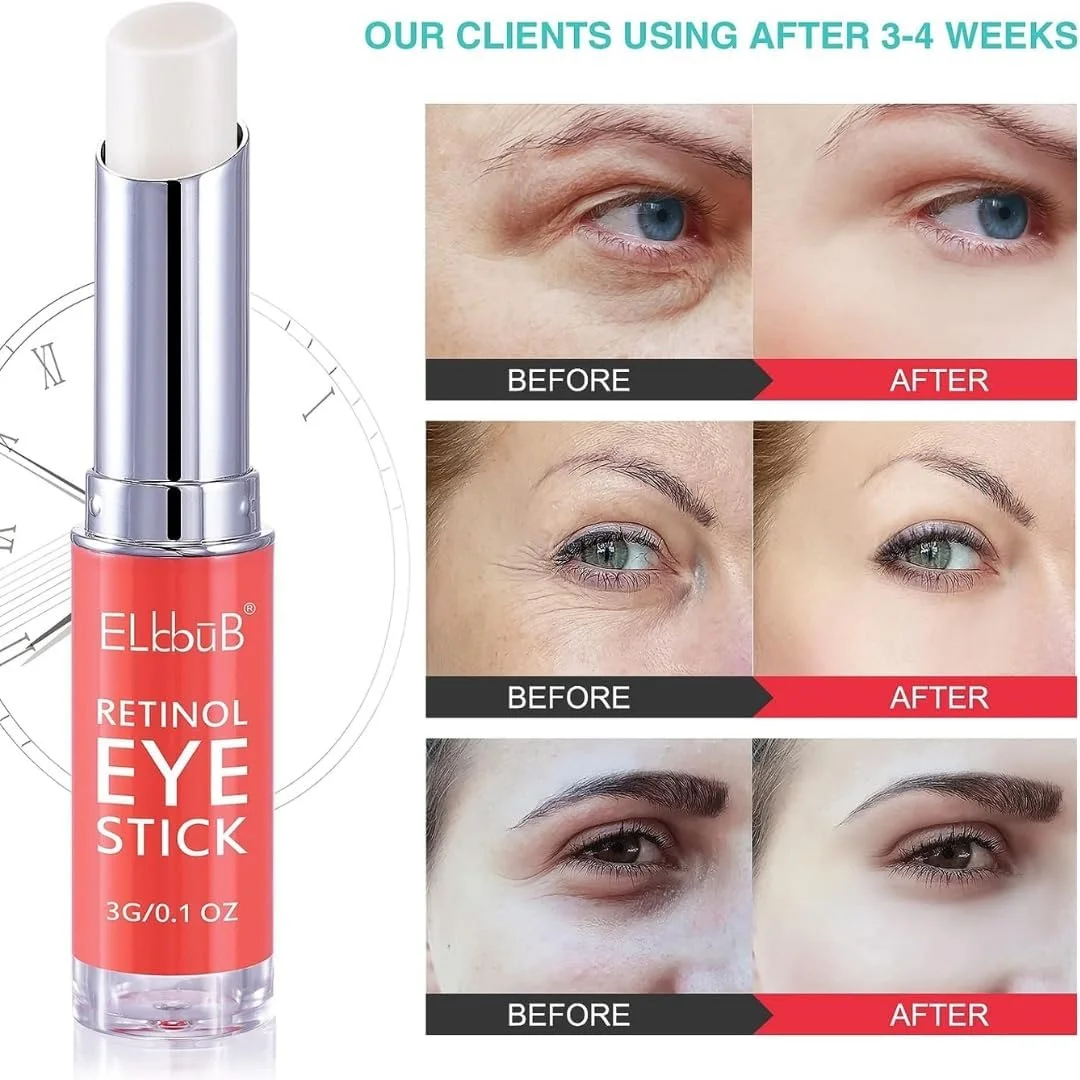 کرم دور چشم رتینول SWEI، استیک دور چشم رتینول برای سیاهی و پف، کرم ضد پیری دور چشم با اسید هیالورونیک، بالم زیر چشم برای سیاهی دور چشم، صاف کننده خطوط ریز و آبرسان ناحیه چشم کرم دور چشم رتینول SWEI، استیک دور چشم رتینول برای سیاهی و پف، کرم ضد پیری دور چشم با اسید هیالورونیک، بالم زیر چشم برای سیاهی دور چشم، صاف کننده خطوط ریز و آبرسان ناحیه چشم