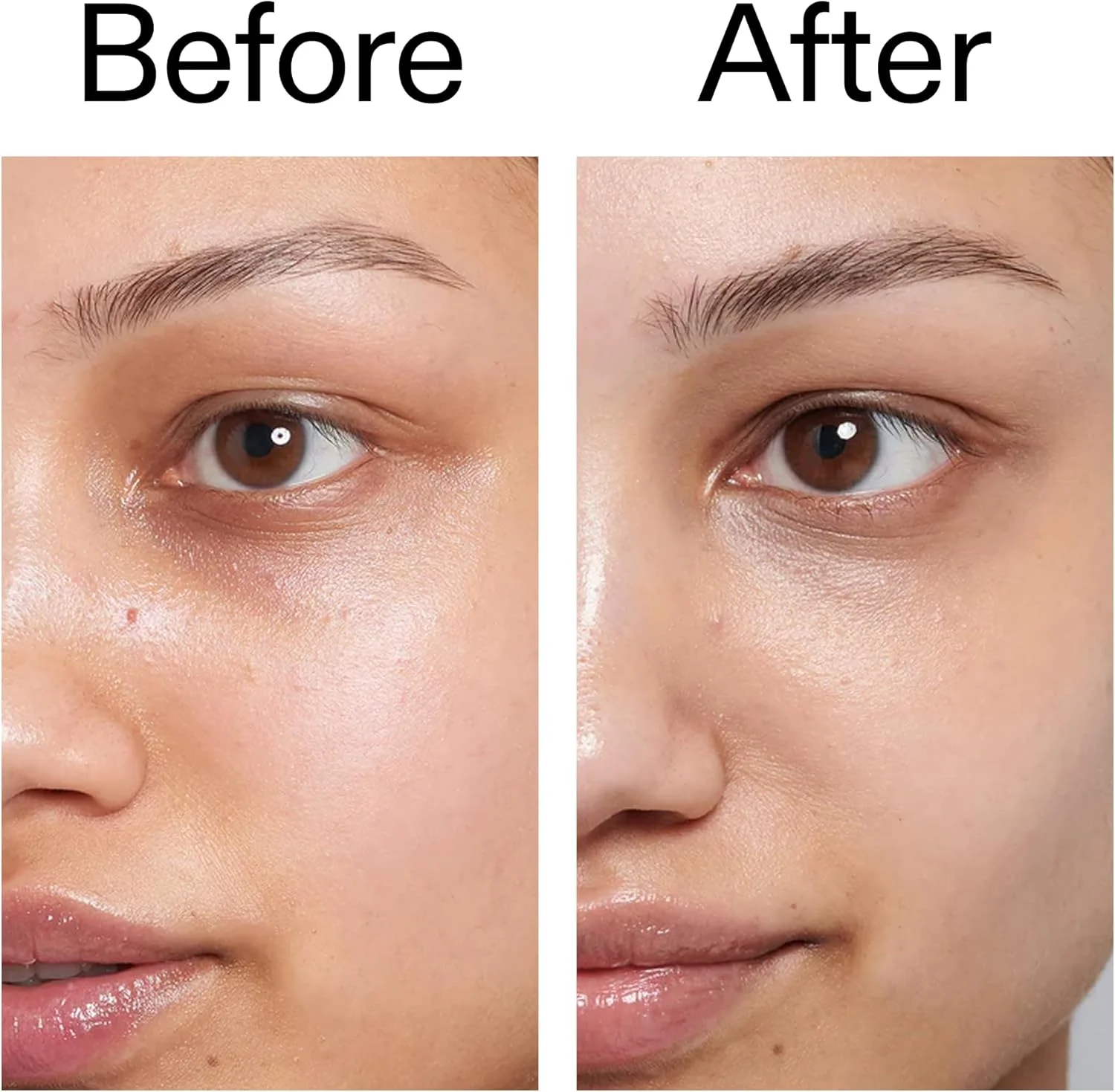 سرم کافئین اینکی لیست 15 میلی لیتر سرم کافئین اینکی لیست 15 میلی لیتر