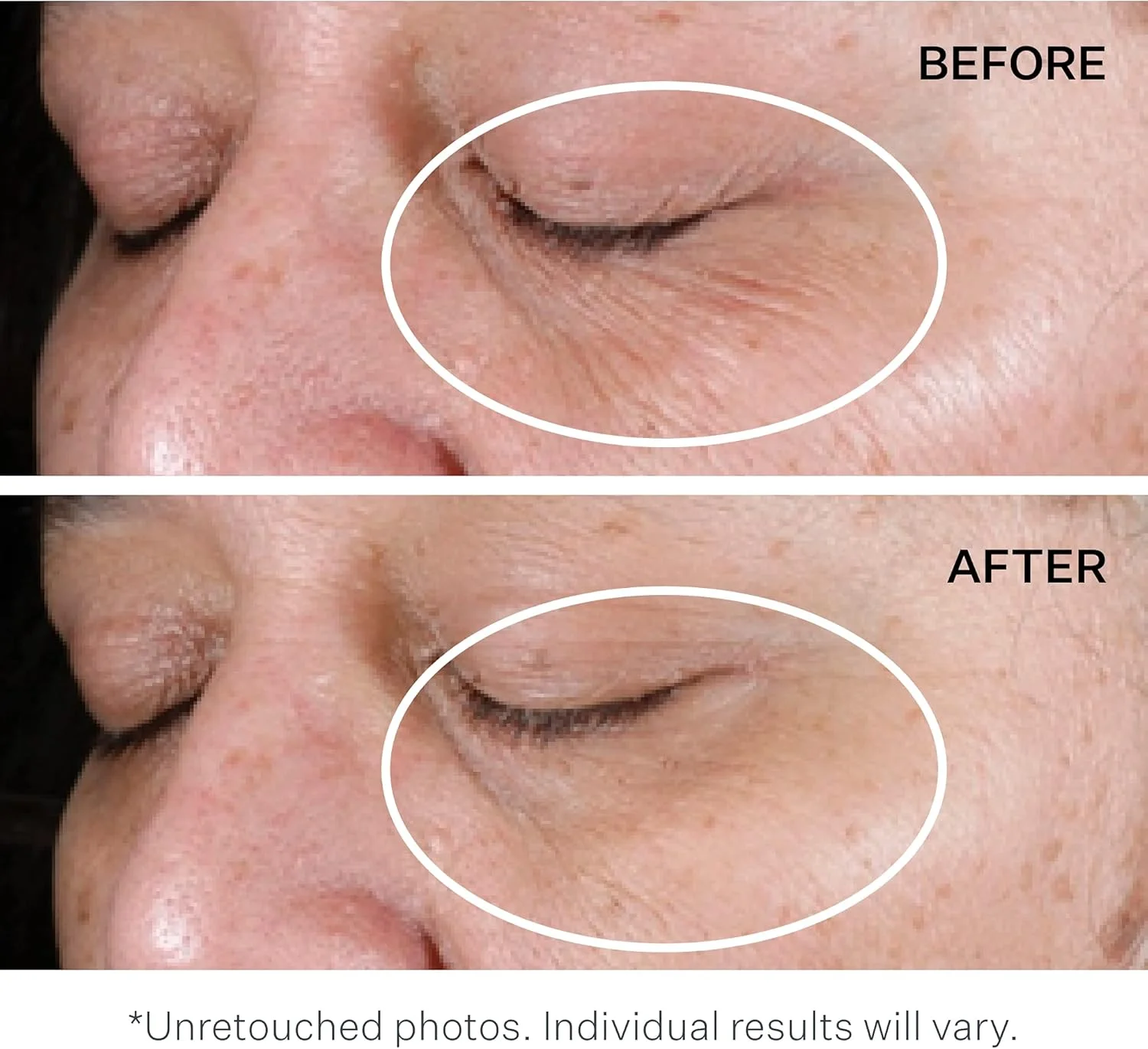 کرم ضد چروک قوی StriVectin، مناسب برای خطوط پیشانی، دور چشم و اطراف دهان، 15 میلی لیتر کرم ضد چروک قوی StriVectin، مناسب برای خطوط پیشانی، دور چشم و اطراف دهان، 15 میلی لیتر